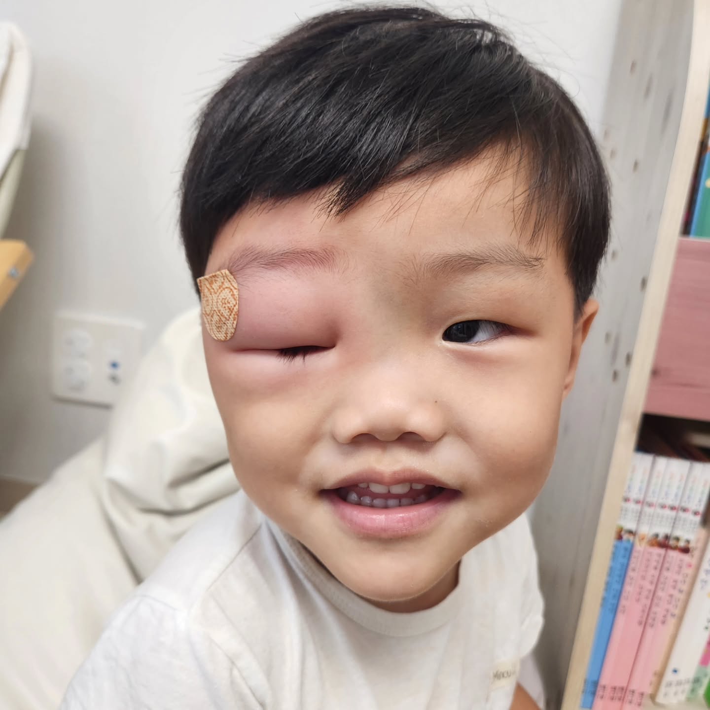 #모기알러지 ..
 어린이집 현장학습가서 모기 물려온 하윤이랑 서우..
분명 괜찮았는데.. 자고 일어나니 하윤이는 퉁퉁부은 팔, 서우는 눈팅밤팅이..😮‍💨