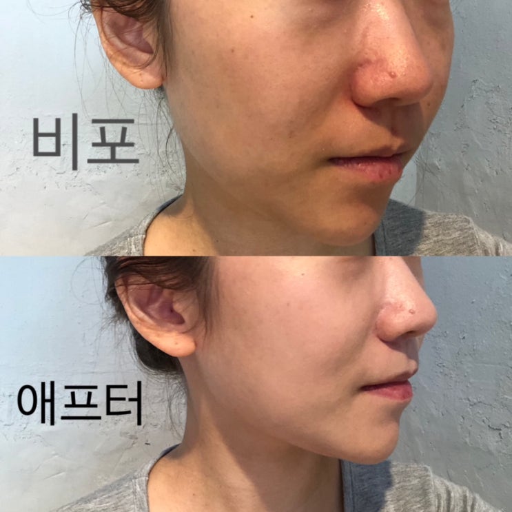 전남대 올리브영 블랑디바 글림커버리지쿠션 커버력 최고