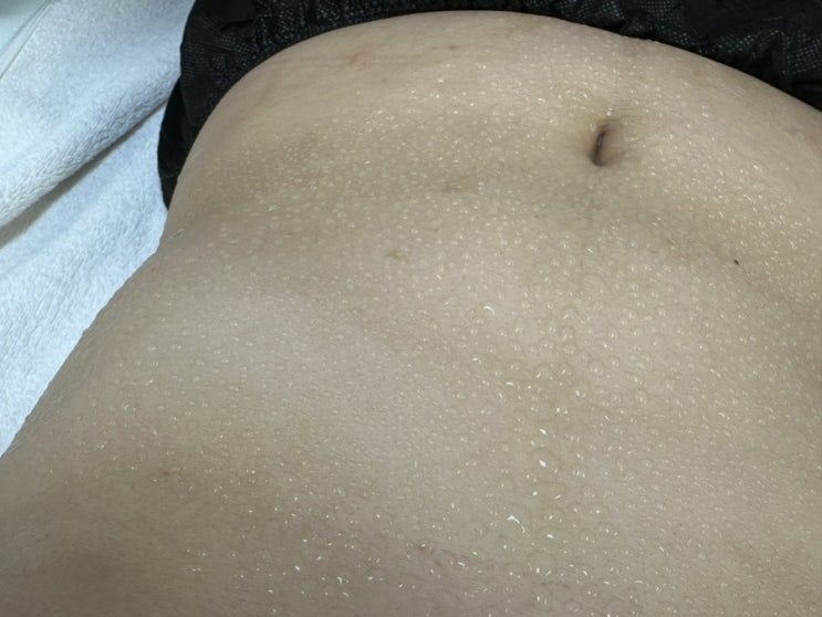 누워서 하는 다이어트 제이알센터 서초동비만클리닉에서 하체슬리밍프로그램1회차 후기