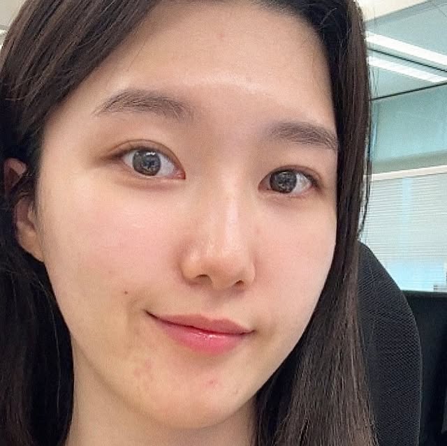 슬기 seulgi on Instagram: "#광고 #헬퓨 #비타민d 

솔직히 비타민D는 중요한 거 알면서도
자꾸 까먹고 안 챙기게 되더라구요 😅
근데 건강검진에서 비타민D 수치 부족 얘기 듣고
제대로 챙겨보자! 해서 선택한 제품이에요 :)

이번에 먹기 시작한 건
✔️ 헬퓨 초소형 비건 비타민D3 2000IU

진짜 작고 미니미한 사이즈라
목 넘김 부담 1도 없고
하루 한 알이면 비타민D 권장량 500% 충족된다는 점에서
간편하고 확실해서 너무 좋더라구요 ☀️

무엇보다 비건 인증 제품이라 더 안심되기도 했고
첨가물 없이 깐깐하게 만든 포뮬러라 꾸준히 먹기에 딱이에요!
가족들도 함께 챙기기 좋아서 언박싱하자마자 이미 추천 완료 🙌🏻

햇빛 많이 못 쬐는 생활이라면
미리미리 챙겨야 할 영양제로 비타민D 완전 필수템이에요!

#비건비타민D #임산부비타민D #비타민D결핍
#비타민D수치 #비타민D2000IU #비타민디효능 #칠월삼일목요일이다"
