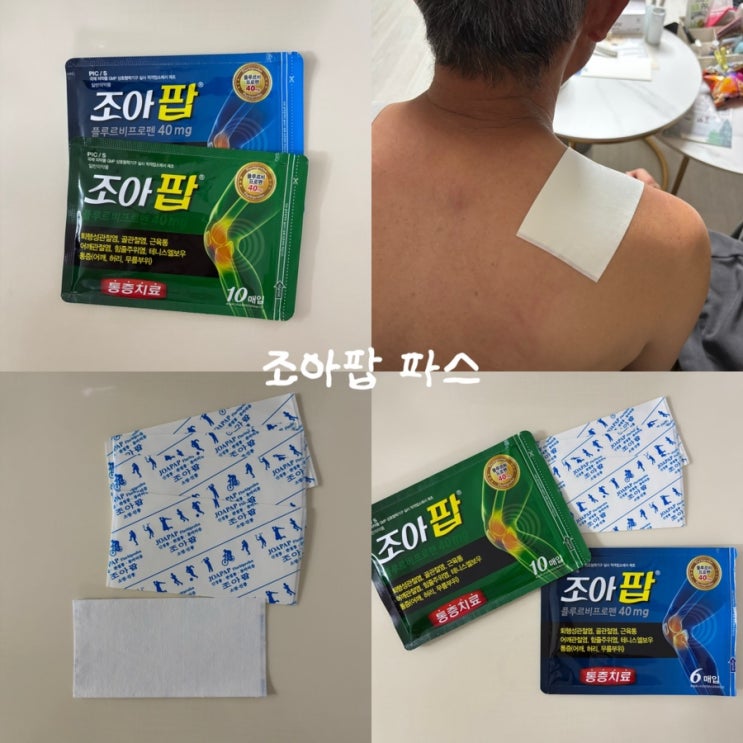 이정재X임지연 주연 [얄미운사랑] ‘조아팝 파스’ 약사추천파스