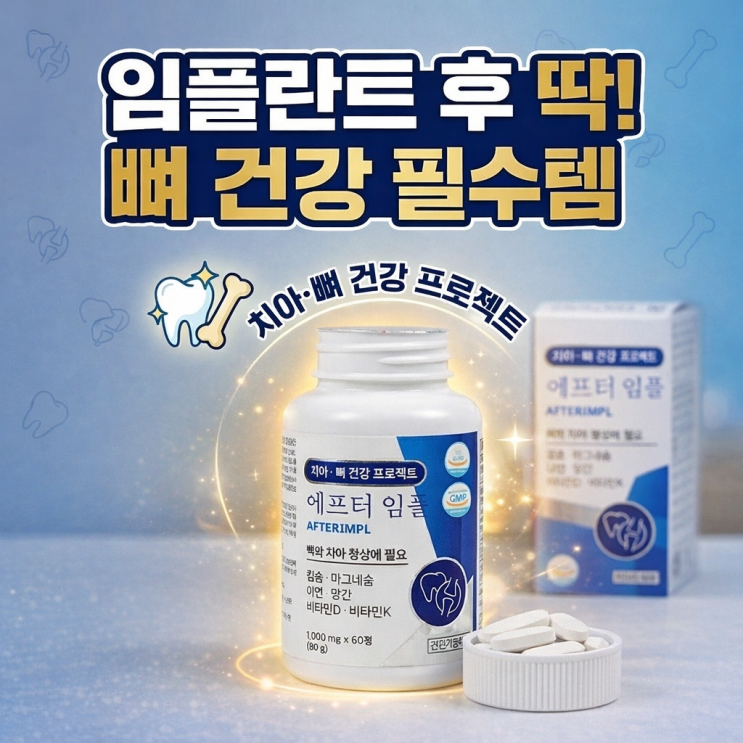 에프터임플 챙기며 느낀 임플란트 흔들림 관리의 중요성