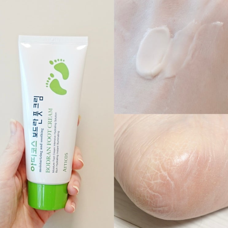 뒷꿈치각질제거 발보습 관리에는 아띠코스 보드란 풋크림