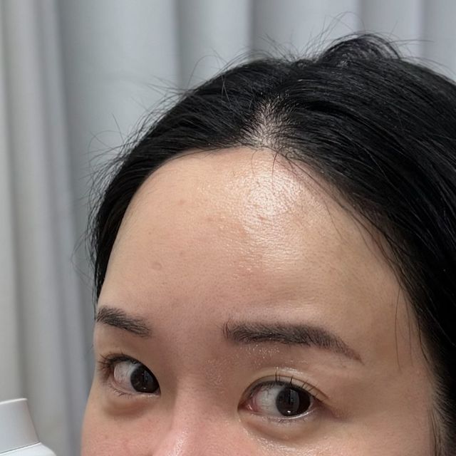 김 은정 on Instagram: "#광고 성인 여드름 고민이신분🙌 저에요🤦‍♀️ 여드름으로 고생하신 분들이라면, 마지막 사진에 독시메디정 저 약 알고 계실거예요😭 트러블에는 여드름 앰플 브랜