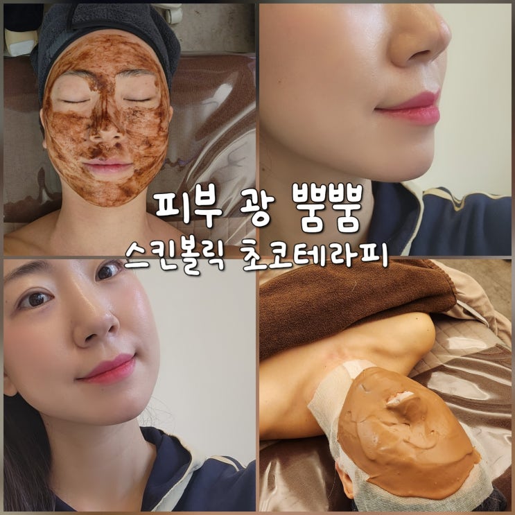 대전 도안동 피부관리 뷰티모아 스킨볼릭 초코테라피