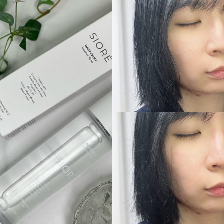 진정토너추천 시오레 데일리 릴리프 에센스 토너 후기