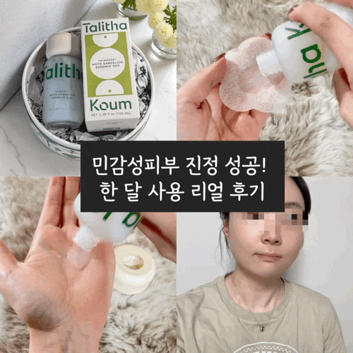 민감성피부를 위한 비건 스킨케어 추천 | 탈리다쿰 화이트 단델리온 에센스 한달 사용 후기
