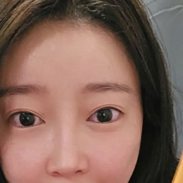 소정 ❣️ on Instagram: "기온변화에 거칠어진 모발 모발관리도필수인 요즘 #맥주효모 로 관리하기‼️
머리감을때마다 빠지는 머리카락과
추워져서그런지 가렵고 건조한 두피를 케어해줘요

✔️햐포에 맥주효모가 3,000mg 함유되어 있다고해요
보통 맥주효모와 비오틴이 고함량이면 피부 트러블 을 걱정하게되는데  피부 상태 개선에 도움을 주는 #판토텐산 이 같이 함유되어 있어 걱정없이 먹을수있어요

먹는시간대 상관없이 하루한포 편하게 섭취해주면 끝!
불규칙 식습관/영양부족인분께 추천 또 추천드려요 💕

#광고#맥주효모비오틴#맥주효모먹는법#맥주효모영양제#맥주효모단백질#맥주효모효능"