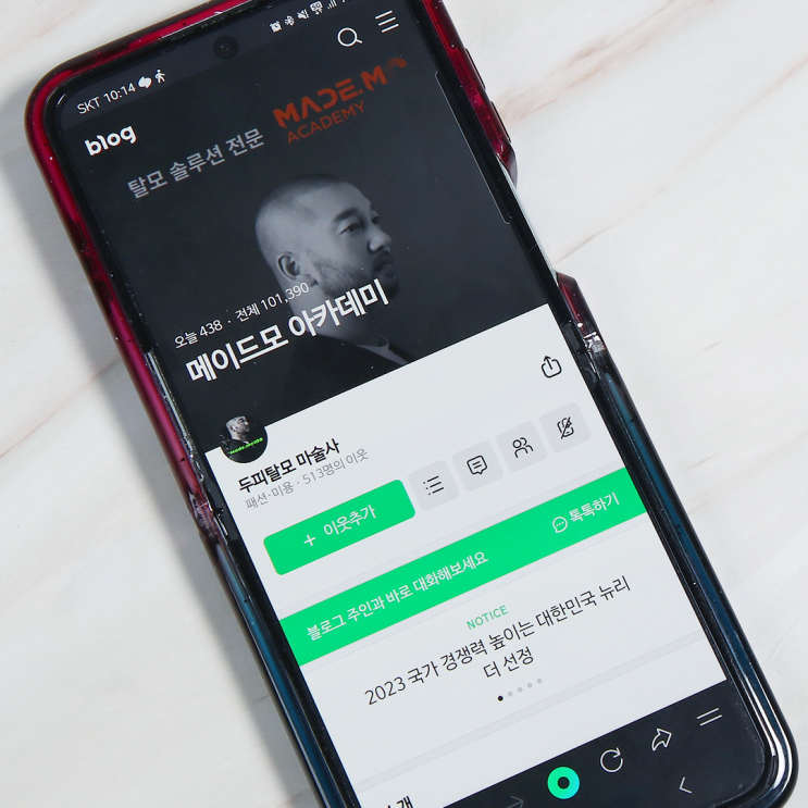 헤어라인 교정 모발생장술 하는 메이드모 아카데미에서 해결