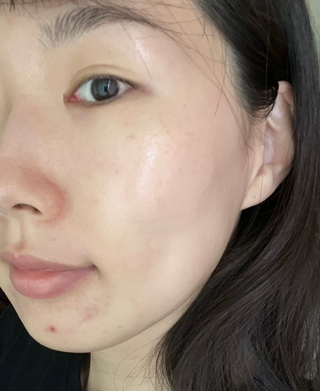 일본 1위 히알루론산 더마뮬러 앰플 30대 수부지 앰플