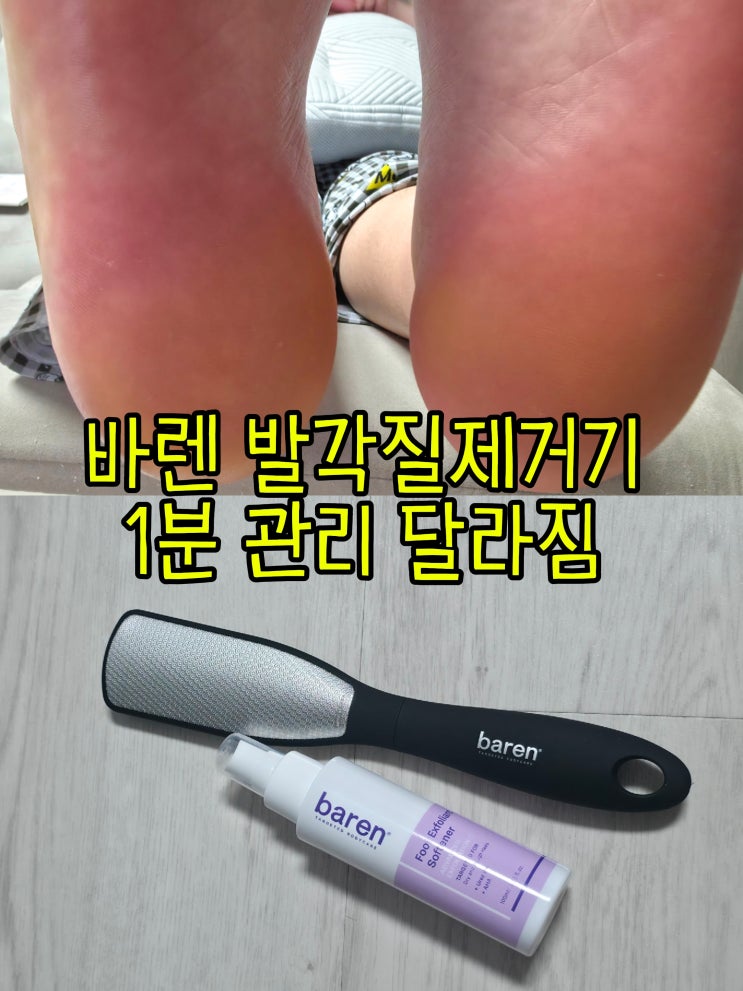 바렌 발각질제거기 써봤는데 발뒤꿈치 굳은살 이렇게 쉽게 밀리네