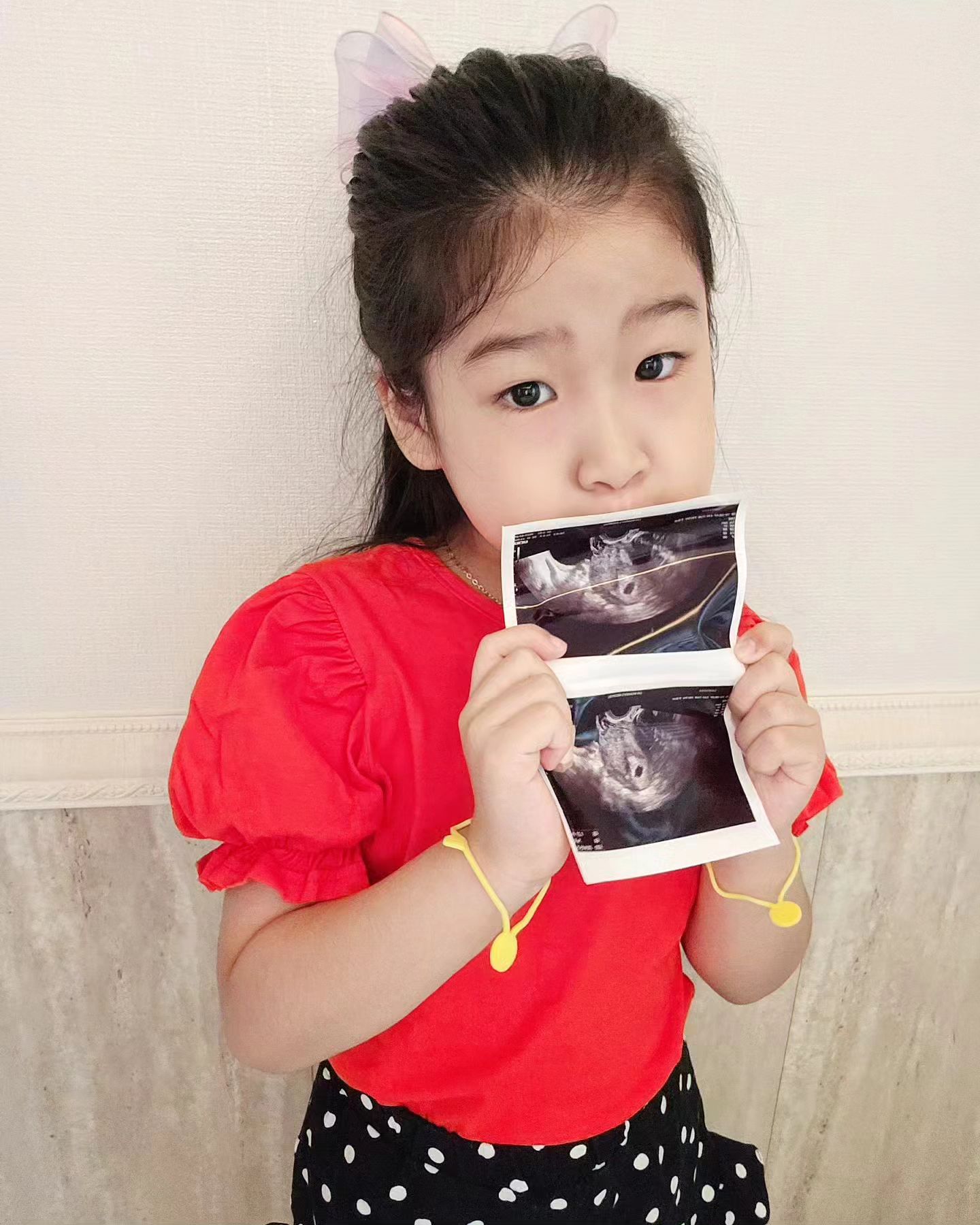 #임밍아웃 

ㅤㅤ
우리서여니 
3년전에도 지금도 
"엄마배에서 나올때 문 열고 나왔어 닫고나왔어~?"
라는 물음에 
"활~짝 열고 나왔어!!" 라고 하더니..

쨘!하고 와준 우리의 두번째천사👶

생각도 못했고 처음엔 너무 당황스럽..
서여니가 커갈수록 둘찌생각은 접었는데🙃

어느날 갑자기 
머리도 계속 아프고 속도 안좋더니
요로케 뱃속에 자리를 잡고 계셨네요..❤️

임신확인하러 서여니랑 병원갔다온날
동생한테 편지도 쓰고 태명도 지어준 내첫찌👧

서여니랑 나이 차이가 많이 나서 걱정이지만
동생태어나면 밥도먹여주고 재워주고 놀아준다고
매일매일 얘기하는 든든한 서여니❣️

7년만에 다시 임신이라 모든게 초기화상태이고
먹토먹토로 입덧지옥에서 살고있지만
둘째 쪼꼬미는 건강하게 잘있대요!

내년 3월에 만나요👐

아! 우리 서여니가 지어준 둘째 태명은
베리 예요🍓
( 이미 서여니 맘속에 동생은 여동생이다..)

ㅤㅤ

#둘째 #애둘맘 #임신초기 #입덧지옥