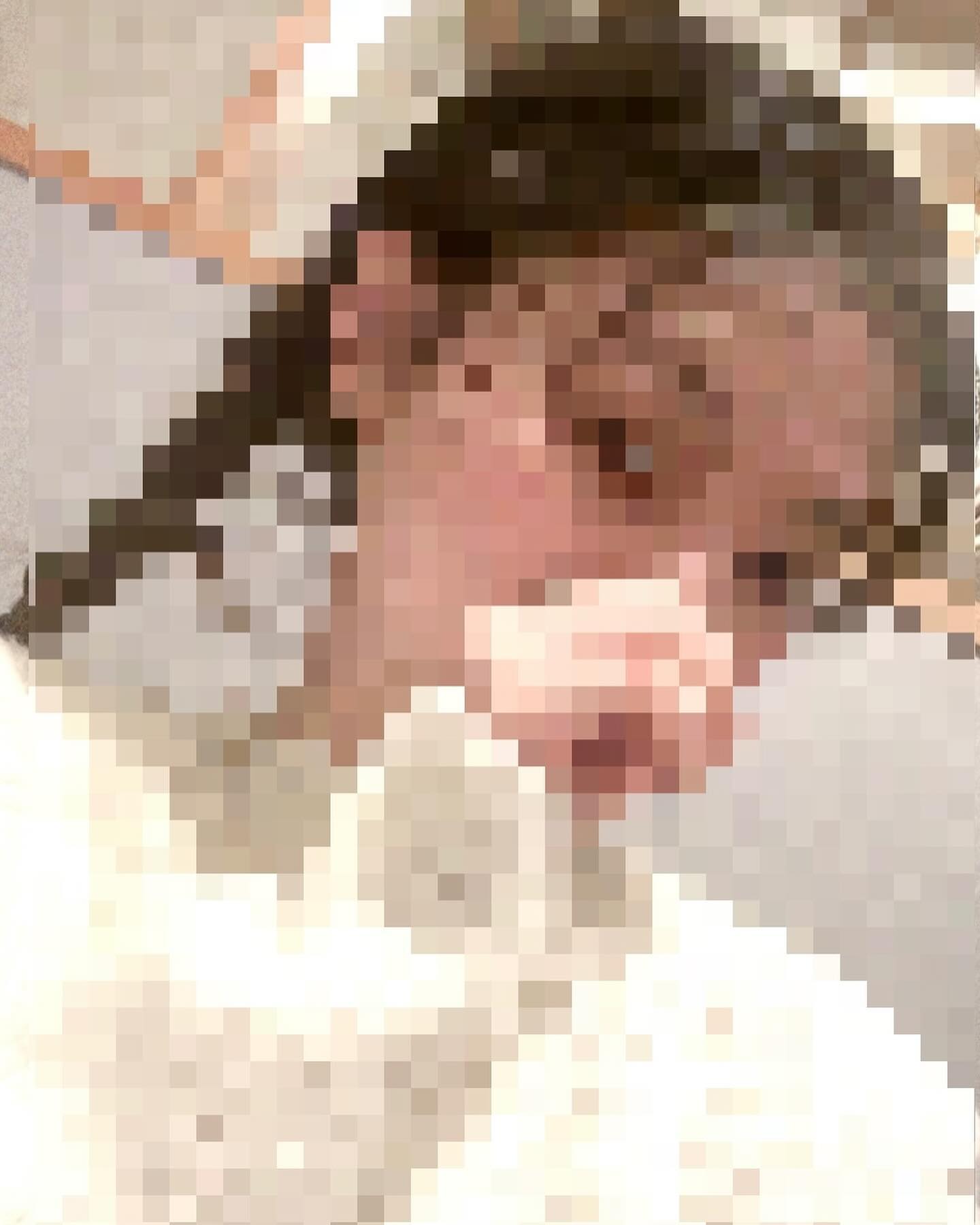 ⏺️🔼⏺️