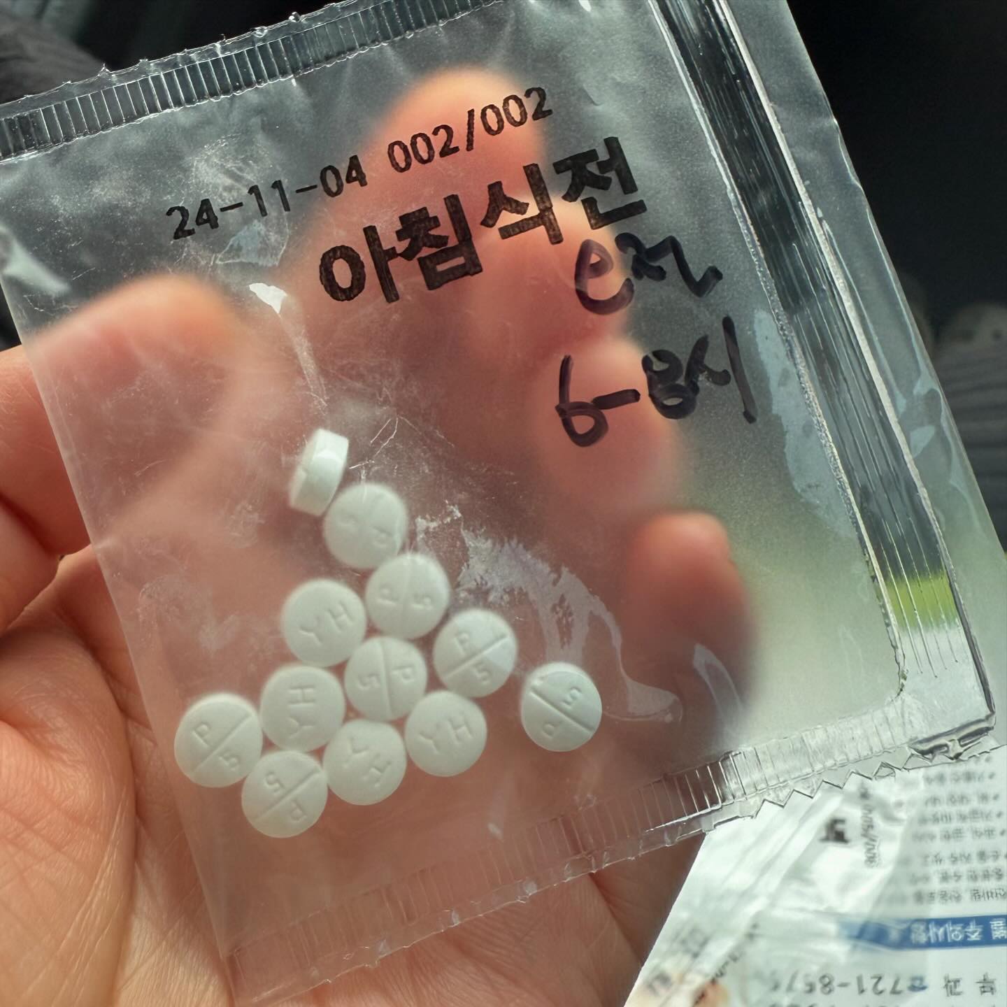 🥹🥹🥹🥹항상 10월~11월만 되면 몸이안좋네
등산은 찬바람 안되고 무리하면 안되서 물건너 갔다😩

스테로이드 12알, 소론도정
그외 약 아점저5개씩
수액 치료도 해야하는데 약물알러지가 많아
사고난다고 의사쌤이 빼자고 했다

나: 선생님 아침약을 몇시에 먹나요?
쌤: ?. 일어나자마자 먹으세요.
나: 제가 불면증으로 늦게자서 (보통4-5시) 점심에 일어나는데요..?
쌤:그럼 6-7시에 일어나서 드셔요
나:알람맞춰두고 먹을게요, 아침약은요?..
쌤:스테로이드제먹고 30분 후요-
🙃🙂🙃🙂

커피금지 술금지 밀가루 금지 단음식 금지
과로 스트레스 금지 절대안정

대충살자 준비된 체력만큼만😉

#기록 #피곤 #일상