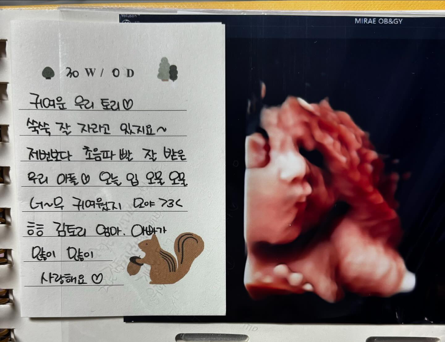 사랑스런 우리 김토리 양배추가 되었지요
오늘은 저번 초음파보다 너무 예쁘게 잘 찍혀찌요>< 
엄마닮아서 코는 동글동글 콧대는 아빠 닮아서 오똑!!! 
우리 이뿌니 언넝 보규싶다아앙❤️ 
주수에 맞게 아주 잘 크고 있구만 벌써 1.5kg라니 ㅎㅎ
엄마아빠가 사랑해 김토리👶🏻💕
2주 후에 보쟝❤️