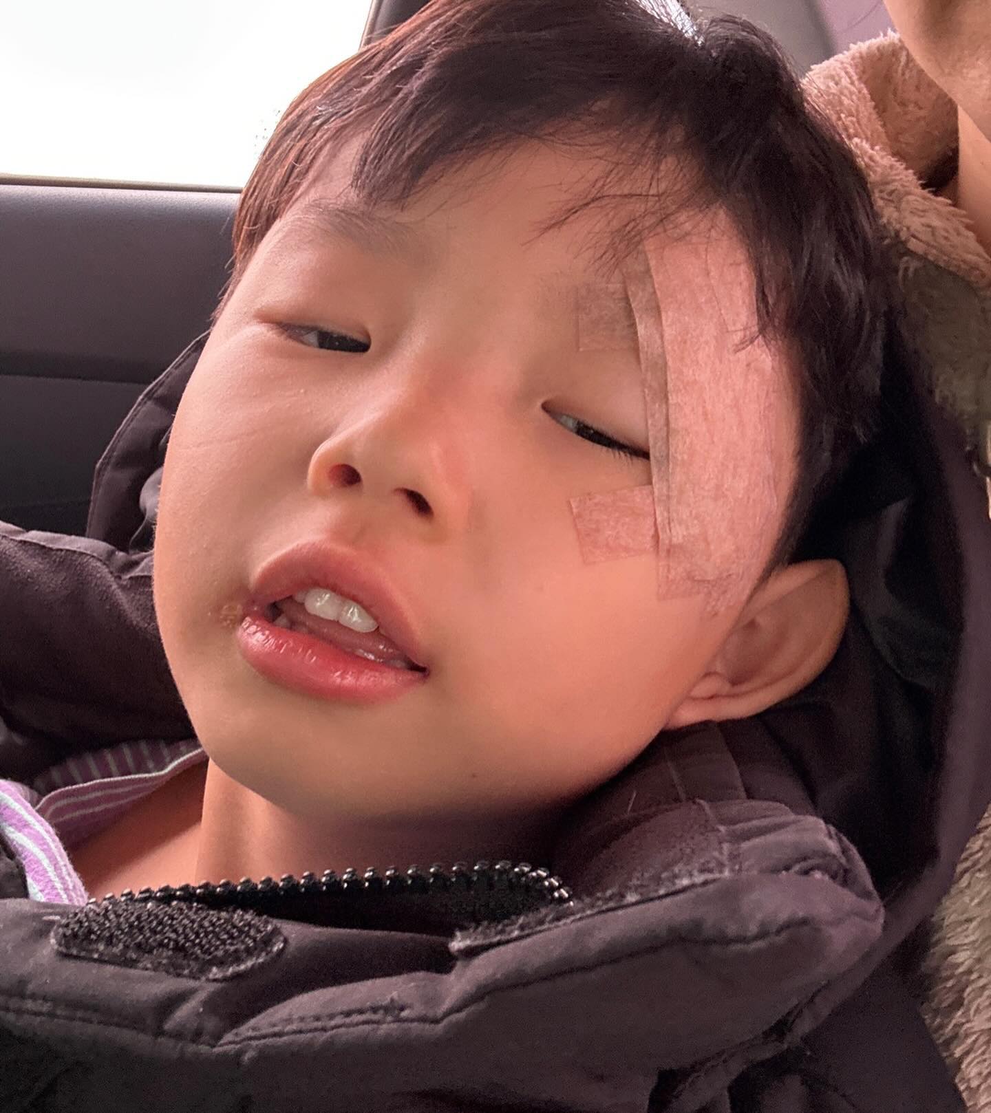 사고뭉치😭
엉아도 얼집에서 눈찢어져서 왔었는데
동생도 따라서 유치원이서 찢어져서 연락옴😱
진짜 심하게 다쳐서 우리 동건이도 너무 놀라고 쌤들도
놀라고, 애미도 놀라고🥺
바람잘날 없다 😓

#아들키우기
#너무어렵네
#3월11일
#잘버텨줘서고마워
#씩씩한아들
#최고야
#아프지말자