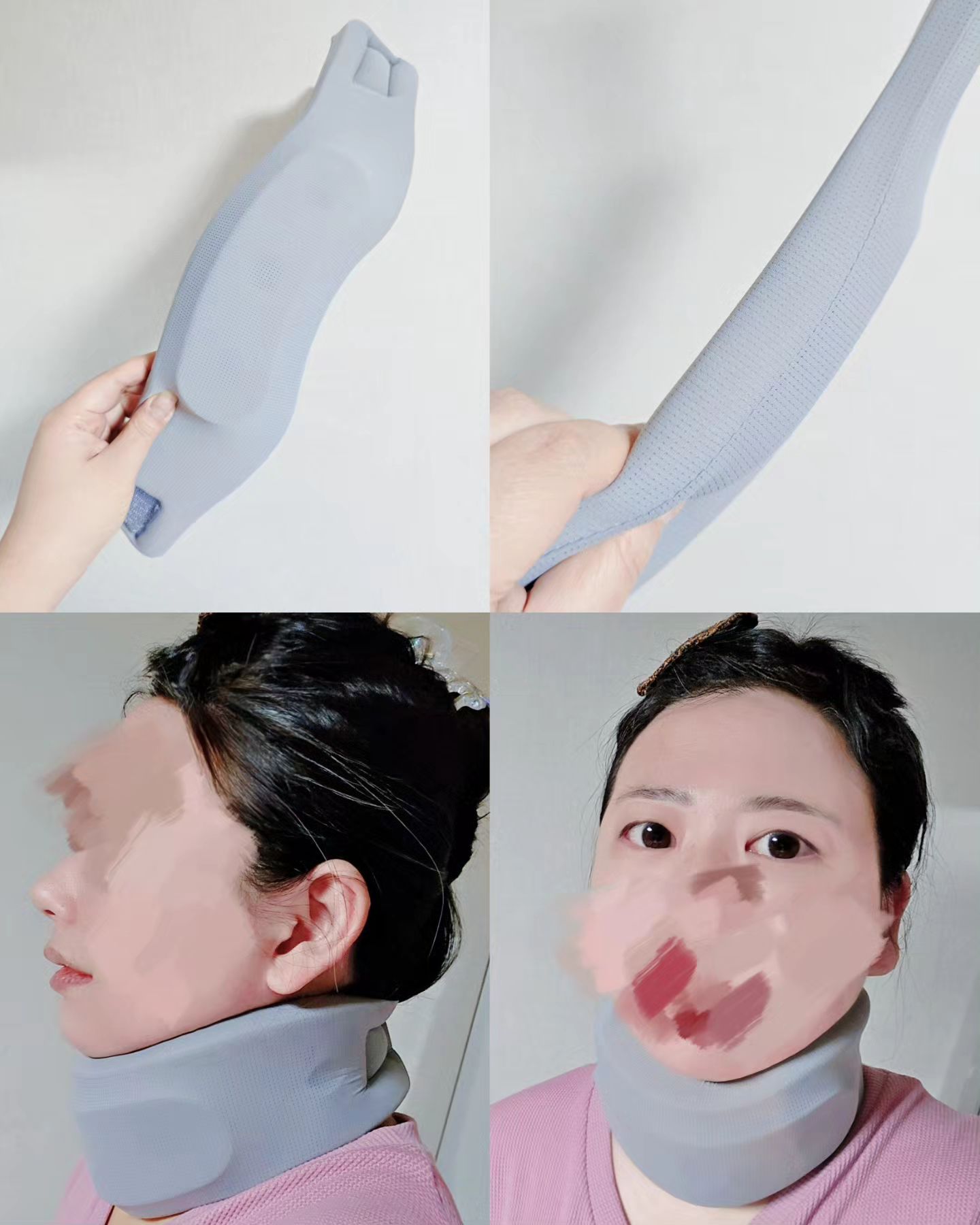 새로운 #목보호대 ㄱㄱ

전에 일상 피드로도 올렸던 기존에 쓰던 #의료용 목 보호대는
고정력이 좋긴 하나 상태가 더 급속도로 안 좋아진 내 몸에는
목 보호대가 닿는 쇄골쪽도 아프고 무게도 무겁게 느껴져서💧

대체품 찾아 #거북목 목 보호대 검색하던 중
무게가 립스틱보다도 가벼운 고작 52g 😳!!!

원래 쓰던 타사것과 달리 지지대가 내장되어 있지는 않지만
메모리 코튼코어를 포함한 고탄성 스펀지 소재라서
더 가볍고 닿아도 덜 아프겠다싶어 질렀는데 매.우.만.족👍
(쿠팡 라즈온 목 밴드 보호대 L , 당시 구매가 18,900원
현재도 하고 있음!!!!!!)

-
약을 바꿔야하나 #진통제 가 안 들음_-
#비급여약 들어있어서 약값도 좀 나온디 2주치인데 안 받음🔥

죽을맛이라 어제도 평소 그 가기 힘든 토요일 오전 진료로 #마취통증의학과 ㄱㄱ해서 #신경주사 조지고 왔는데
최근 왼쪽 #갈비뼈통증 도 와대고 통증이 안 올라와도
살짝만 터치해도 엄청 아파서 말을 했더니...

주사 맞느라 누워있는 상태에서 체크하신다고
여기냐고 하시면서 누르시는데.. 

바로 아파요 아파요 아파요 속사포로 말하면서
발 동동 온몸 비틀고;;; 눈물 바로 나고 난리부르스;;;
... 그런데도 빨리 손 안 뗏음... 그래서 분기탱천했던건 안비밀...
(분기탱천했으나 겉으로는 눈은 질질 아파서 말할 정신도 없었음;)

-
암튼 바로 어제 맞고 왔는데도
몸이 이상타_-

#신경차단술 약빨이 다 된건가, 부작용인건가

원래도 있는 후두부를 포함한 #두통 에 #경추통 #능형근통증
손목 + 발목 #통증 이야 말할것도 없고
아까전부터 오른손 엄지손가락 쪽 순간순간 힘줄이랑 혈관을
엄청 끄집어대는듯한 통증과, 그쪽 안에서부터 열이 나는 느낌;

아니면 이 죽일놈의 #경추 때문에 온
#말초신경장애 가 더 심해져서 그런건가...

암튼 원장님과 다시 깊은 대화를...
(갈비뼈 다신 못 누르게 해야지-_-)

-
좋은 소식을 전해야하는데 자꾸 안 좋아지는것만 전해
송구합니다ㅜ...

엄청 쉬고 엄청 관리하는데 왜 자꾸 아픈데가 느는지...씨봉 ㅠㅠ...

암튼 항상 하는 말이지만...
#경추관리 꼭 하세요ㅠㅠ.... #건강이제일중요