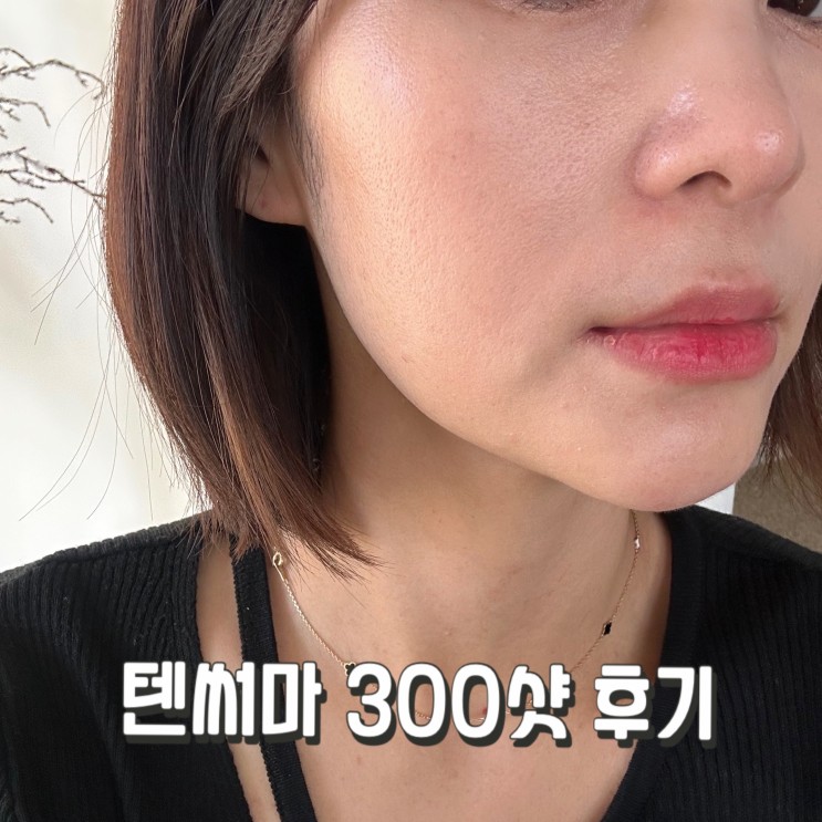 청주 피부과 추천 ; 피부탄력과 주름개선 리프팅 텐써마300샷 후기!