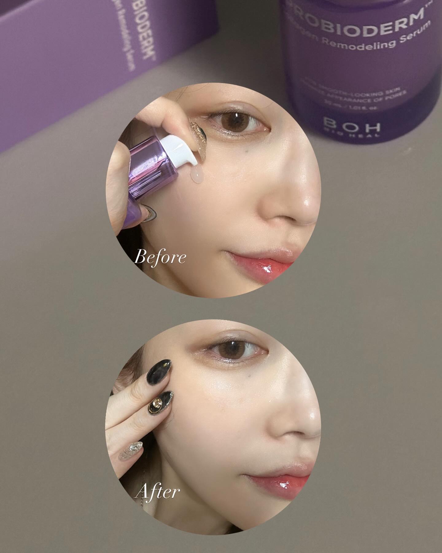#광고 bioheal.boh_official 
처진 모공 퀵 교정, 바이오힐보 프로바이오덤 콜라겐 리모델링 세럼💜
✔️모공 속 콜라겐을 채워 바로잡는 모공 교정 세럼
✔️5일 모공 교정 효과, 매끈 모공 케어
✔️핵심 콜라겐 성분 업그레이드, 7대 모공 고민 개선
✔️끈적임 없는 산뜻 탱글 세럼 타입
✔️프로바이오덤™️, 써마콜라겐 캡슐 함유(즉각적인 타이트닝 효과)

-
처진 피부와 모공을 빠르게 콜라겐을 채우고 잡아주는 바이오힐보 new콜라겐 세럼! 무겁지 않은 워터리한 제형에 촉촉하고 산뜻한 마무리감으로 데일리에 부담 없이 사용이 가능하고, 5일만 사용해도 쫀쫀 모공 타이트닝 효과와 즉각적인 주름개선 효과를 느낄 수 있습니다~👏🏻
현재 4월 19일까지, 올리브영 온라인몰에서 콜라겐 리모델링 세럼 구매 후 공식 인스타그램 내 구글폼에 인증하면 <올리브영 5천원 상품권>을 전원 지급해주는 리뷰 이벤트를 진행한다고 하니 다들 놓치지 마시고 득템하세요😀

#바이오힐보 #처진모공퀵교정 #5일모공교정세럼 #모공세럼 #올리브영세럼 #올리브영모공세럼 #모공케어 #모공관리 #세럼추천 #올리브영추천템