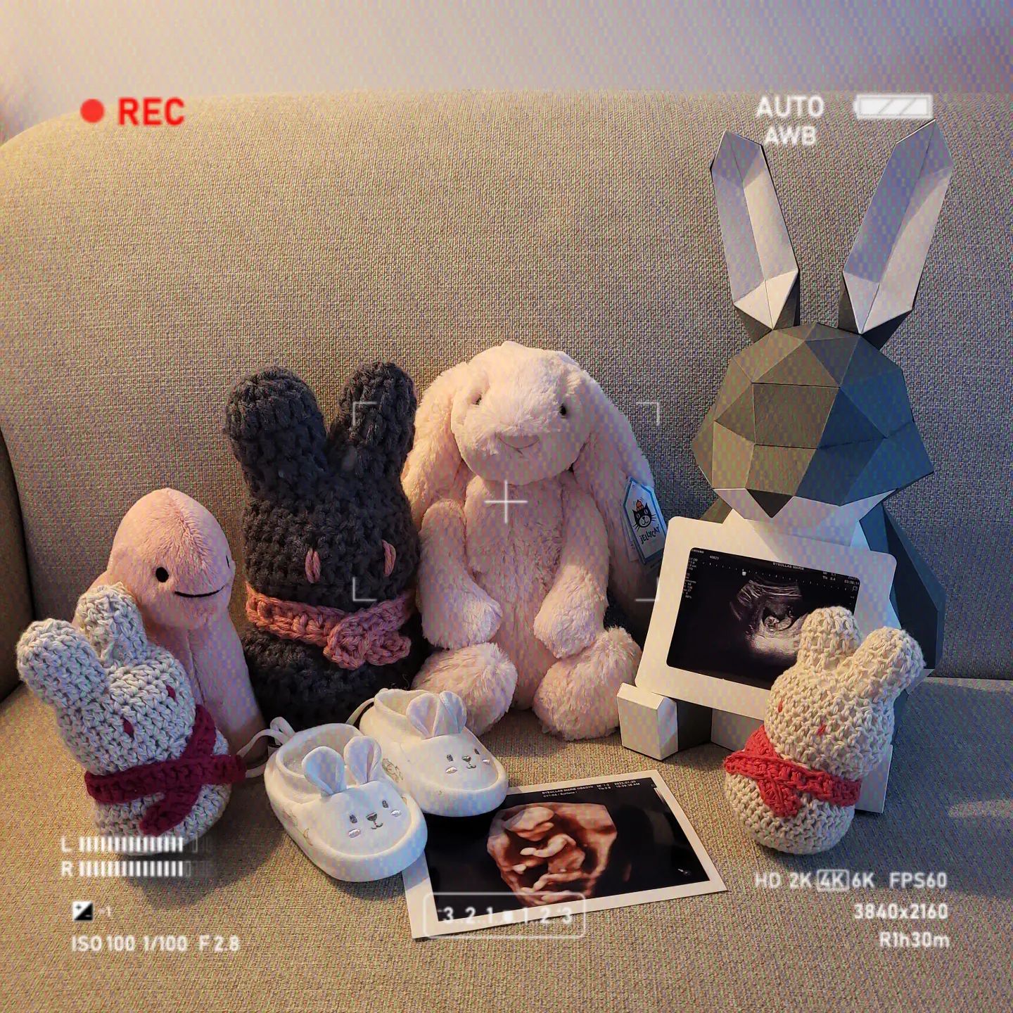 #임밍아웃 🐰💖 #13w2d
결혼한지 엊그제같은데 토끼같은 여름이가 오빠와 저에게 깜짝 선물처럼 찾아왔어요🐰 

12주에 촬영하고 온 초음파 영상에서 여름이는 벌써부터 뱃속에서 신나게 점프도하고 팔도 들고 벌써 사람모양을 하고선 신나게 놀고있는걸 보니 엄청난 에너자이저가 될거 같아요 ㅎㅎㅎㅎ

작년 한해는 결혼준비와 결혼으로 정신없이 행복하게 지나갔는데 올 한해는 여름이를 맞이할 준비와 여름이와 함께할 시간들로 또 정신없이 행복할거 같아서 너무 설레고 기쁩니다✨️

초기엔 입덧과 갑작스러운 변화에 감정요동도 심해 잘 헤쳐나갈 수 있을까 싶었는데 남편이 그만큼 보살펴주고 보듬어주어 부모가 되는 길에 한발짝 힘차게 내딛을 수 있었던거 같아요 ㅎㅎ

초보 엄마와 초보 아빠의 고군분투 성장기가 되겠지만 여름이에게 부끄럽지 않은 부모로써 서로를 아끼고 위하면서 서로에게 행복이 되겠습니다 많이 부족하겠지만 애정어린 시선으로 지켜봐주세요💖