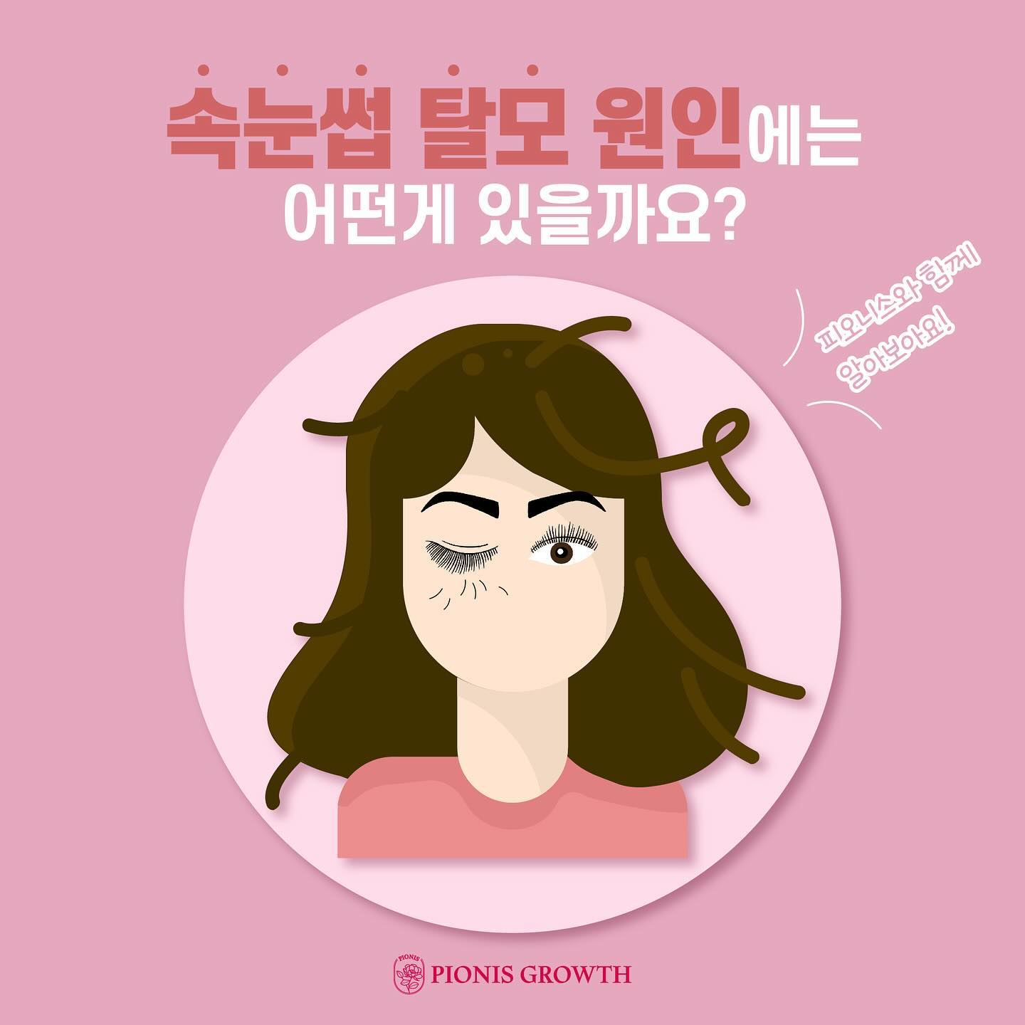 속눈썹 탈모 원인, 그게 대체 뭔데❓

1️⃣아이 메이크업
-마스카라, 아이라이너와 같은 눈 화장을 하게되면
할 때나 지울 때 마찰이 일어나 속눈썹 탈모에 영향을 주게 됩니다

2️⃣인조 속눈썹 탈부착
-인조 속눈썹이 빠질 때 진짜 내 속눈썹도 같이 빠지기 때문에
자주 하지 않는것을 권장합니다

3️⃣속눈썹 영양 부족
-속눈썹도 털의 일종이므로 영양분이 부족하게 되면 속눈썹이 빠지기도 합니다

4️⃣스트레스와 노화
-스트레스는 속눈썹의 성장 활동을 둔화시키기도 합니다

5️⃣모낭충
-모낭충은 모낭을 붓게 만들고, 염증을 일으켜 속눈썹 탈모의 원인이 될 수 있습니다

그 외에 질병이나 일상생활 속 잘못된 습관으로 속눈썹 탈모가 올 수 있습니다

🙄어떻게 하면 속눈썹 탈모를 개선시킬 수 있을까❓

✔정답은 피오니스❣
✔속눈썹 모를 건강하게 해주고 모발성장에 필요한
영양을 공급해주어 모발이 굵고 진해지고 풍성해지는 관리😊
✔속눈썹뿐만 아니라 두피, 헤어라인, 눈썹 등 
모발 성장을 원하는 모든 부위에 관리가 가능➰➰

➡️➡️ 독보적인 기술을 가지고있는
프리미엄 #피오니스 생장케어는
피오니스 공식대리점 
💛페르레이뷰티💛에서➿➿

#생장술 #속눈썹생장술 #모발생장술 #두피생장술 #피오니스생장술 #피오니스 #탈모관리 #두피관리 #탈모생장술 #피오니스그로스 #대구생장술 #달서구생장술 #속눈썹생장 #성주탈모관리 #달서구탈모 #공식대리점 #대구탈모전문