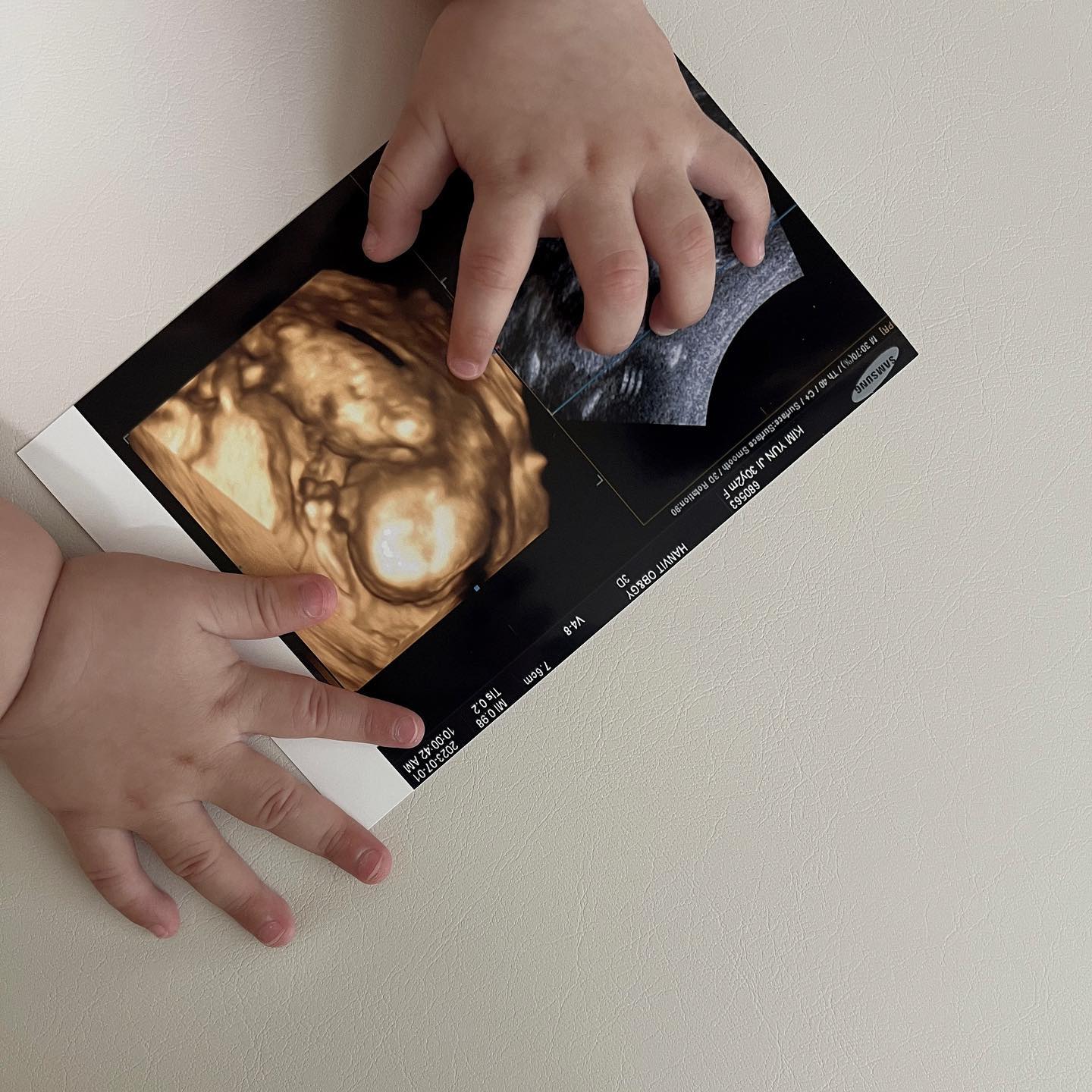 15w 3d
⠀
아린이네집에 소중한
또 하나의 선물이 찾아왔어요.ᐟ
⠀
조금 이른 방문에
여러가지 걱정도 고민도
⠀
특히 원인불명 조산이었던
첫 출산이었기에 둘째도
가능성이 작지 않아
⠀
그런 부분으로도
걱정이 참 많았었는데
⠀
보내주신 이유가 있고
지켜낼 자신이 있고
든든한 남편이 있기에
⠀
저는 감사함으로만
받아들이기로 다짐했어요˘͈ᵕ˘͈
⠀
태명은 포근한 사람이
되라는 의미에서 ❝구름❞
⠀
그리고 아마도 아린이는
언니가 될 것 같아요
⠀
걱정보다는 많은 축복과
건강하게 커서 열 달 꽉 채워
만날 수 있길 기도해주세요 ෆ
⠀