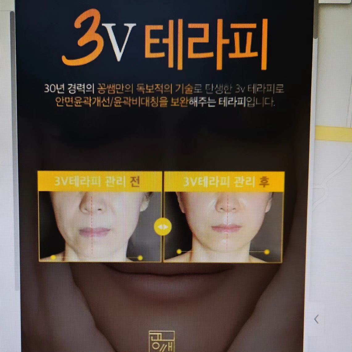 정말 통증없는 윤곽관리를 원한다면 마인 애스테틱 강력 추천 드립니다.
물리치료사 출긴이셔거 체형관리도 해주세요