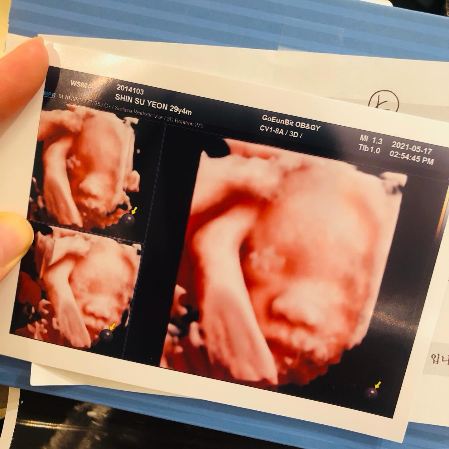 #입체초음파 
첫째 서준이👦🏻
둘째 해피👦🏻
셋째 러브👧🏻

닮은듯 아닌듯
닮은 삼남매 초음파
나와서 보면
너무 귀엽겠지🫶🏻

사랑둥이들
잘 크고 빨리 만나장

#삼남매 #내가다둥이맘이라니🤦🏼‍♀️ #다둥이맘 
#첫째아들 #둘째아들 #셋째딸 #남매둥이 #🐰🐰