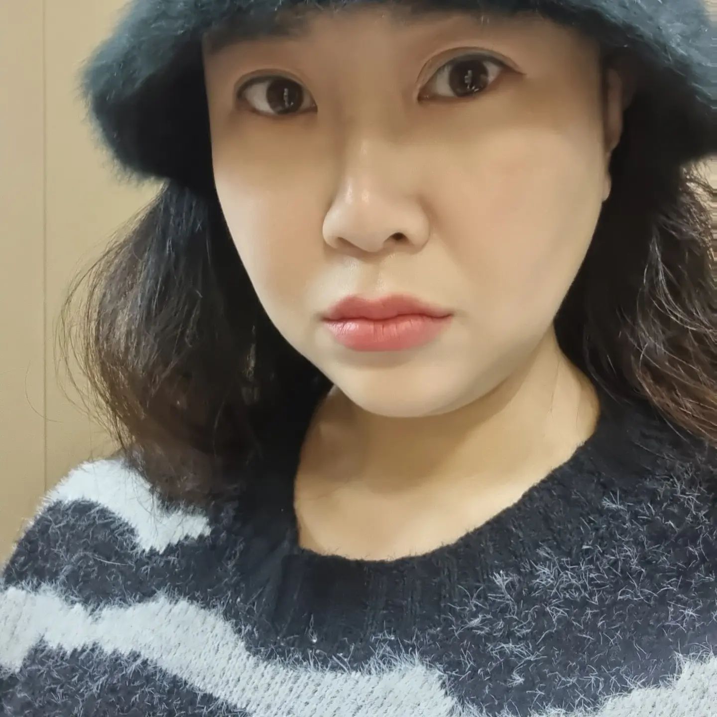 요즘 🤮토나올 정도로 바쁘게 지내다보니 몰랐는데
쌍커플까지 신경쓰이게 합니다

이거 어뜩해야하나요😭
재수술 해야하나요?

쌍수 전문가의 답변 기다립니다😭

#쌍커플 #쌍수 #쌍커플재수술 #성형 

Q. 쌍수 다시 할까요?