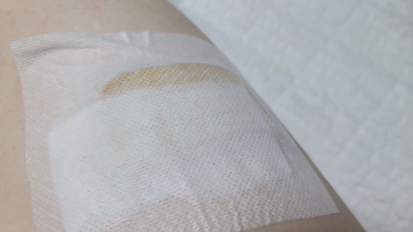 #천안의악몽 #화가난다화가나😡

친구랑 급 병천순대국 먹고 싶어서 차 빌려서 천안으로 감 ㅋㅋ 맛집 원래가려던 곳이 줄이 길어서  급 검색 후 현지인이 제일 많이 가는 곳이라고 해서 네이버평점도 가려던데보다 훨 높고해서 모 순대국집을 찾아감
아침부터 굶고 연휴차막힘을 뚫고ㅋㅋ 
2시간 반 만에 도착한 곳에서 30분이상 웨이팅하고 기대로 가득차 순대국을 시켰는데 알바생이 테이블에 팔팔 끓고있는 순대국을 쏟음.. 내 다리로 국물이 꽤 흘러서  따가웠지만 손님도 많고 바로 조치해주겠지하고 아픈거 참고 기다렸는데 느릿느릿 행주가져 와서 테이블이랑 바닥을 닦고있음ㅡ..ㅡ그래서 내가 걱정된 친구가 뭐하는 거냐고 아이씨(소리냄)ㅂ(소리안냄)이라고 했더니 알바생 내 상태는 안중에 없이 친구한테만 욕하지 마세요라며 정색 후 화냄..
(원래 욕 못하고 안하는 친구라 물어보니 자기도 모르게 욱해서 나오더라함 그래도 욕은 소리를 삼켰는데 알바생이 다친 나를 신경안쓰고 자기 보고 화내서 어이없고 엄청 화가났다함) 

친구가 대판하려는 거 말리고 
아픈 소리 크게 안냈더니 나에게 얼음이나 물수건을 가져다 줄 생각이 1도 없는 것 같길래 화장실로 가서 확인하려고 보니 
화장실에 손님이 있어서 옷 살짝띄워서 기다리는 데(거기 주인할머니인지 화장실앞에 기다리지말라고 함 ㅡㅡ;; 초기화상진압실패) 화장실에서 상태를 확인해보니 생각보다 꽤 큰 물집에 초반보다 점점더 쓰라려서 친구한테 병원가야겠다하고 짐챙기니 주인할머니가 자기가 보자며 자기쓰는 연고라며 (얼마 있지도 않은...) 그거 바르면 다 났는다며 ㅋ상처를 보자길래 보여줬더니 '에게~ '그걸로 무슨 병원이냐 약 바르면 났는 다 함 ㅋㅋ하아다시생각해도열받..
(알바생은 병원가야할 것 같다소리듣더니 미안하다고 함, 진심으로미안해 하는 거 같았음)
째든 완전 쏟은 건 아니고 어린친구의 실수라 그리고 영업중가게에 피해주기 싫어서 조용히 병원가려 하는 사람 굳이 잡아서 안아픈데 병원가려하는 사람취급..

옆에 주방에서 여사장(?)인듯..
째든 젊은 여자분이 보험처리하라고 내 전화번호 받아놔라는데 할머니사장 굳이하더니 핸펀뒷번호5자리 명함을 줌 ㅋ구래도 혹시몰라 전화번호남기려는 데 옆에서 지금 병원하는데 없을꺼라며ㅋㅋ
계속 병원 갈 때 없는데,만 반복 함 미안한 기색없음 ㅋㅋ (가야되는데 우짜노였음 화안남 이 동네 병원갈 때 없다며 웃으며말함..내기분탓일꺼라믿고싶음..)

일단 어찌저찌 친구가 찾은 천안시내에 있는 피부과가서 치료받음....
자기네가 보험처리하라했으니까 하려고 서류떼려보니 병원서 보험사마다 필요서류다르다며..나중에 부족한건 다시본인이 왔다가야한다함
뚜벅이라 서울집에서 쉽게 왔다갔다 할 수 있는 상황도 아니고 해서.. 서류 떼가게 첨에 명함에 써있는 핸펀으로 전화했는데 가게 아니라함..;;; 검색해서 식당전화번호 확인 후 전화함, 필요서류 알려달라함
젊은 여사장이(아까보험처리하라던) 의사가 뭐라하더냐길래 주사맞고 드레싱해주고 연휴 분 5일치 약이랑 연고 처방받아갈꺼라고했더니 갑자기 자기가 성당에 다닌다나 뭐라나ㅋㅋ 별로 안다쳐서 다행이래...하아..
아...예..하고는 째든 서류 알아보고 전화달라하고 끊음ㅋㅋㅋㅋ

좀 기다리고 있으니 전화 옴, 
담당자가 연휴라 전화를 안받는 다며 ㅋㅋ
연휴끝나면 보험에게 말해둘테니 자기쪽으로 다시 연락하지 말라며 ㅋㅋㅋ
연락 할 필요없다나? 연락올꺼라며 ㅋㅋㅋ어이없지만 일단 계산하고 혹시모를 대비 서류 돈주고 뽑아옴.. 급 빈정상한이유 말투가 별로 안다쳤으면서 귀찮게 하지말라는 듯... 보험사가 알아서해줄꺼래 
하아.. 나는 서류달라는 전화 한번함 

째든 2도화상은 화상도 아닌가벼..
병원비도 꽤 나왔는데 이거
영업방해안되려고 참았더니 얼마 안 다친걸 귀찮은 사람취급, 병원비만받으려는데 뭐 블랙커슈머취급..
씁쓸... 맛집탐방데이였는데 병자되서 돌아옴 ㅋㅋ 5일이나 약먹으래ㅠ 

씻고 드레싱 갈다보니 쓰라리고 또 갑자기 욱해서 급 글을 남기는 중ㅋ ㅋㅋ 
또 항생제 먹을 생각에 짜증나고 알바생 외에 진심 어린 사과는 받아보지 못했고 ㅋㅋㅋ
쓰다보니 더 화가난다 화가 👹😡
맛집이고 나발이고 ㅋㅋ
절대 안감 
 
아 진짜 영업집이고 나발이고 아프다 뒹굴고 아프다고 소리치며 울었어야했나 ㄷㄷㄷ
이래저래 치료받느라 오후 4시에나 한끼 먹고 하루일정날림

역시 쓸데없는 배려..는 호구되는 지름길임을 느낌 
먼가 화를 더 토하고 싶은데 더이상 길게 안써져서 짜잉 

#화남그램😡 #가게이름써버려?