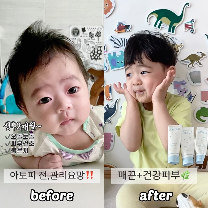 아토피직전, 킨더로 고민해결✊🏻 제이야기뿐만 아니라 이제는 우리 아듀x킨더팸들 많은분들이 스토어에 작성해주는 진솔한 후기만 봐도
알 수 있는데요....!🩷
⠀ 
생후 2개월쯤부터 시작된 건조함. 초보엄마는 어떻게해야하나
병원에 내원할 때 마다 가슴졸이며
아토피만 아니어라!!! 하고 신생아때
습도맞추려고 고생, 온갖제품들 다 사서 그당시
돈ㅈㄹ도 진짜 많이했어요ㅠ 얼굴에 바르는것인 만큼 당근?노노
테스트할 겸 무조건 새 제품 사줘야쥬~ㅜ

제품마다 애바애가 있다한들
✅아토피,민감성피부,동전습진,건조,오돌토돌 친구들
✅유해물질ZERO!!! 자연유래성분!!!!
✅상처와 치유 재생에 좋은 마데카소사이드성분
✅윤광가득 탄탄하게 만드는 수분촉촉 세라마이드
✅타 오일 섞지않고 고순도 스쿠알란만 100%담은 킨더오일
✅눈에 거품이 들어가도 따가움1도없는 킨더바스까지!!!

그냥,,, 제 육아인생 1등템입니다⭐️👍🏻
⠀ 
🧴🧴🧴
영유아 스킨케어는 사실 일반화장품군에서도
가장 좋은성분❗️즉, 순하고 트러블유발물질 등
최대한 피하고 피해만든다는 것 잘 아실텐데요~!
그 모든걸 완벽하게 만들어 제조부터 마감까지 모두
100%밀봉 이중캡으로 발송나가는게바로
#킨더브리제
⠀ 
오픈과 동시에 빠른속도로 주문쭉쮹‼️
⠀ 
18차공구 ! 구매이벤트 자동참여‼️
내일오전 9시반 당일출고 시작해요‼️
⠀