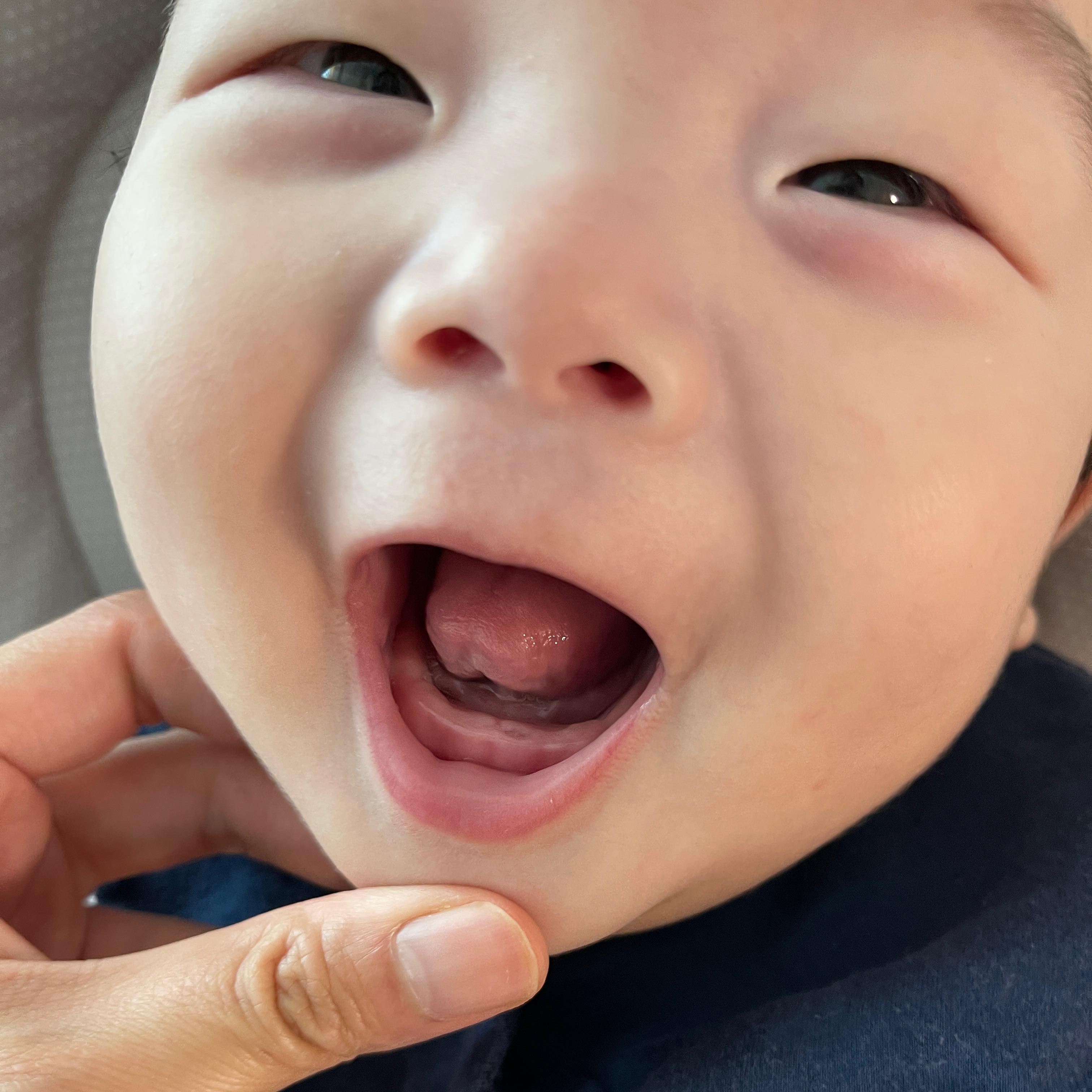 7월 첫날

늦게 나오려나 싶었는데 구멍이!!

아랫니가 나와용🤍

이앓이 없는 편인듯 효자아들

#아랫니 #첫니 #첫니가났어요 #첫니뿅 #아랫니뿅