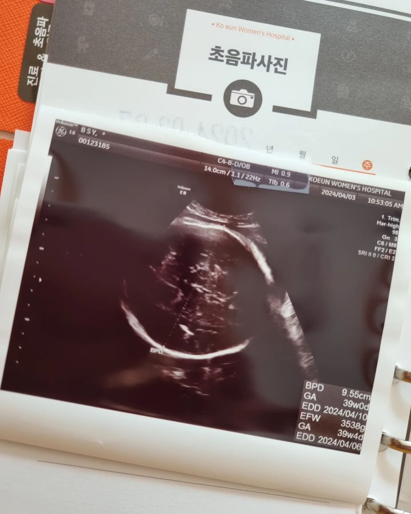 [마지막 1주일]
희망아, 어제 너를 보러 갔는데
1주일 사이에 0.5kg가 쪘더라 ㅠㅠ
엄마가 1주일동안 너무 맛있는 걸 많이 먹었지?? 😁
3.5kg가 되고 철분수치도 더 떨어져
엄마는 철분수액도 맞고 다음 주 월요일에
다시 진료 본 후에 어떻게 할지 정해야해!

운동열심히 하라 하셔서
수봉공원을 걷다왔는데
처음가보는 길로 가다보니 신기하더라.

희망이가 엄마 봄맞이 구경 하라고 그랬나보다 ㅎㅎ
수봉공원이 너무 예쁘더라.

벌써 햇살도 따뜻하고
꽃들도 피어오르고
이제 진통와서 널 만나기만 하면 딱이야!^^

38주 전에는 진통도 조금 와서
경부길이가 짧아졌다 괜찮았다해서
조산기때문에 걱정했는데
이제는 너가 커져서 
진통이 안 와서 자궁문도 2cm 열려서
자연분만을 못할까 걱정하네.
참 세상은 매번 다르게 걱정을 해 ㅎㅎ
하지만 하나님이 적당한 때에
너를 만나게 해주실거라
큰 걱정은 안하고 소소한 걱정만 할께 ㅎㅎ

엄마도 운동 열심히 할께 곧 만나자!!
내일도 수봉공원이나 타야겠다 ㅎㅎ
그리고 이제 겨울 옷 정리해야겠다.
둘째 형아도 겨울 옷 정리하다 만났어 ㅎㅎ

#임신39주 #임신10개월
#디데이6일 #임산부
#임신막달 #임산부운동 
#수봉공원 #걷기
#걷기운동 #진통기다리기