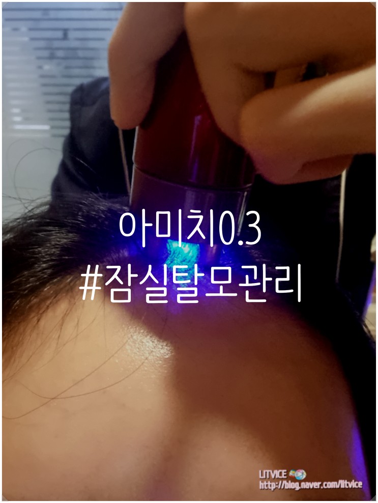 잠실탈모관리 아미치0.3 탈모에서 비듬까지 다 잡아주는 곳
