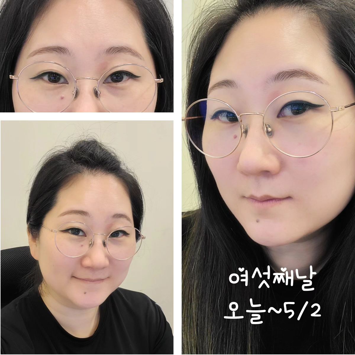 찰난했던 나의 주말 ㅋㅋ 
짜잔~ 속눈썹했는데 눈썹반영구를
안하면 섭하죠잉 😘🤗

그래서 또 다른 변신 도전!!♡

💟 성남 위례반영구 뷰티더영 💟
 
찾아 가실 곳
경기 성남시 수정구 위례서일로 26 라크리움 B104호

0507-1359-4769

플레이스주소
https://naver.me/53XvyniE

반영구뿐 아니라 왁싱 케어도 합니다~
원장님 친절하시고

샵도 아늑해서 좋더라고요 ㅎㅎ

자신감의 시작 해보시죠 ㅍㅎ😘

자세한건 제 블로그에 담았어요~
프로필하단 주소타고 오세요!

#협찬 #성남반영구 #위례반영구 #송파반영구 
#뷰티더영 #눈썹문신잘하는곳