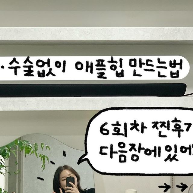  누카의 서울상경생활기 on Instagram: "#광고 • 시술 없이 타고난 애플힙🍎 만드는 법
최근에 스토리에서 주구장창 올렸던 저의 침 맞는 모습🥹
뭔지 말하고 싶어서 드릉드릉 입이 얼마나 근질거렸다구요.
시간 없으신 분들은 그냥 두번째 장만 확인하시라우✨✨
⠀
저는 대둔근 및 중둔근 발달이 부족한 편이어서 .... ㅠ
힙딥도 심하고 전체적으로 처진 엉동이라 늘 고민이었어요. 
운동을 해도 힙딥이 더 패이거나(?!) 예쁘게 커지진 않더라고요.
⠀
그러던 와중에 (무려 강남에서) 시술이나 수술 없이도 
타고난 애플힙을 만들어준다는 곳이 있어서
진짜 냉큼 찾아가서 현재까지도 꾸준히 받고 있는 중이에요. 
오픈한지 얼마 안되어 세련되고 고급스러운 플랜테리어에
원장님께서 나긋나긋 쏘 스윗하게 침을 놔주시는 곳이랍니다.
매번 밝게 맞아주시는 이사님과는 이제 찐친되어부림✨
⠀
사실 저는 그냥 막연히 느끼고만 있었는데, 
피드 하려고 비포 에프터 사진 보니까 진짜 효과 머선일😮
남은 회차도 꼭 열심히 다녀야지 다짐하게되네요^^v
⠀
✔ 제 피드를 보고 방문하실 경우 특별 할인 해주신대요.ᐟ
✔ 자세한 정보가 궁금하신분들은 DM 주세요 : ) 
⠀
⠀
⠀
💛 #누카의_서울상경생활기
#힙성형 #힙업성형 #엉덩이성형 #힙딥 #힙딥제거 #힙필러 #자연산애플힙 #엉덩이근육성장 #중둔근발달 #엉덩이지방이식 #엉덩이커지는법 #힙업운동 #골반필러 #비절개엉덩이성형 #비절개힙성형 #엉덩이수술 #애플힙 #골반이식 #골반지방이식 #엉덩이확대 #엉덩이주사 #짝궁뎅이교정 #짝궁뎅이 #엉덩이비대칭 #체형교정 #강남힙성형 #강남힙필러 #강남엉덩이성형"