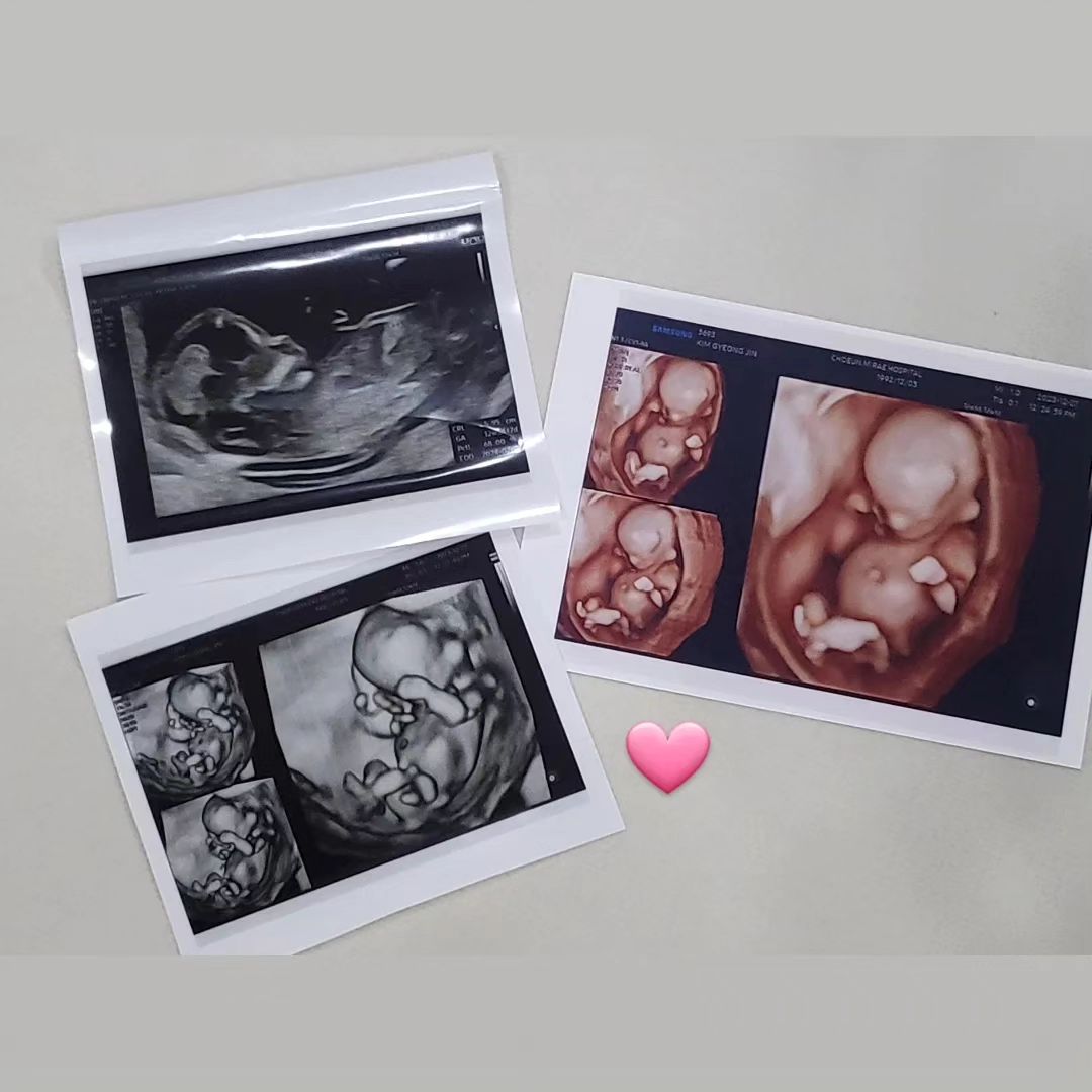 지유 동생이 생겼어요👶

 둘째 생각은 진작에 있었지만,
생각처럼 아기천사가 와주지 않아서
맘고생을 좀 했찌만....!!!
 와줘서 너무 고맙구 고마운 우리 으뜸이
뱃속에서
무럭무럭 건강하게 자라서
보쟈, 으뜸아🩷
.
.
#임밍아웃 #12주 #둘째맘 #👶
