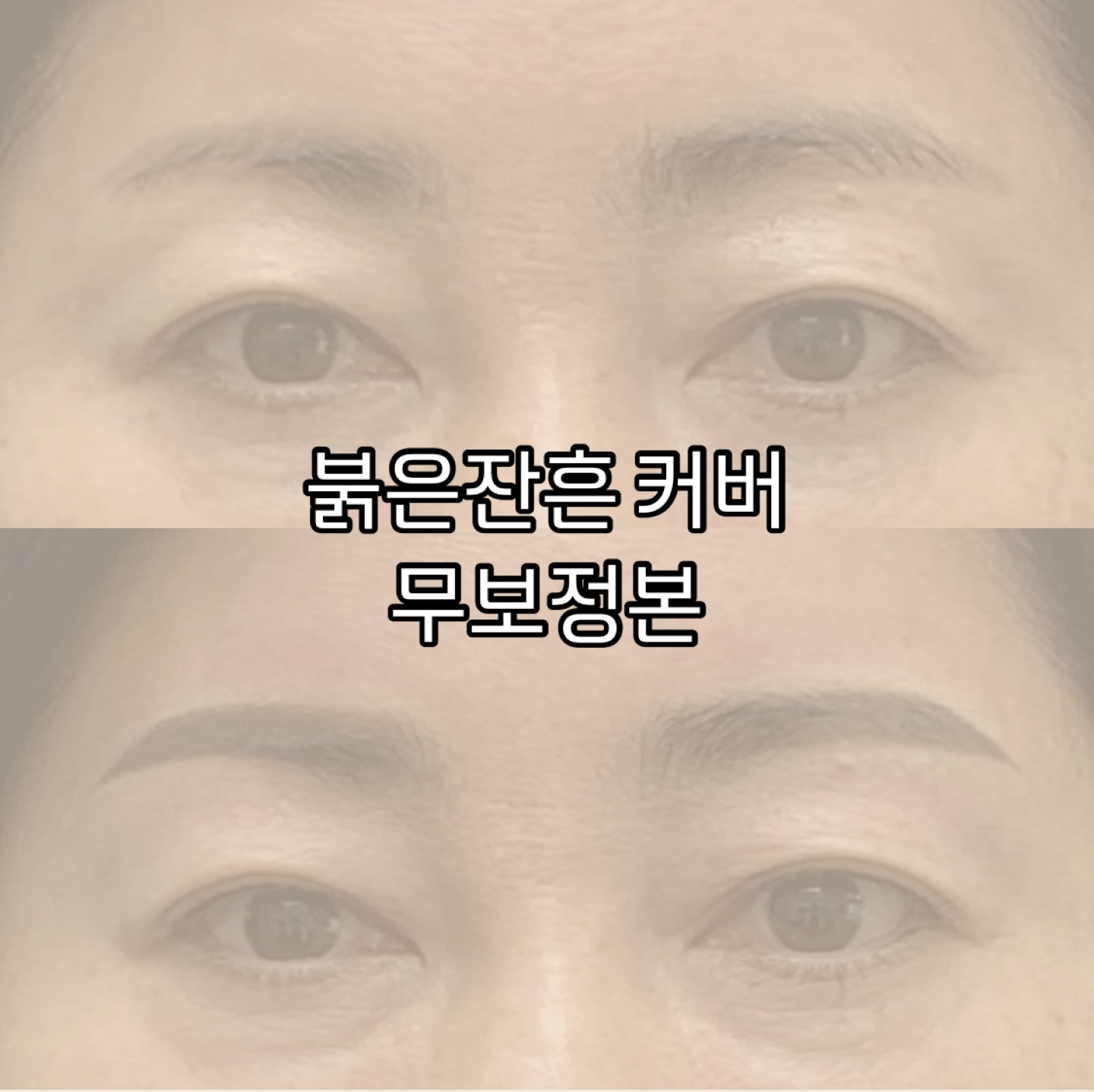 어두운 붉은색의 잔흔을 차분한 브라운톤으로 커버업 해드렸답니다❤️
조금 튀어 나오는 잔흔은 감안 하신다 하셔서 가장 예쁜 디자인으로 만들어 드렸어욤

#대구 #대구잔흔커버 #눈썹.