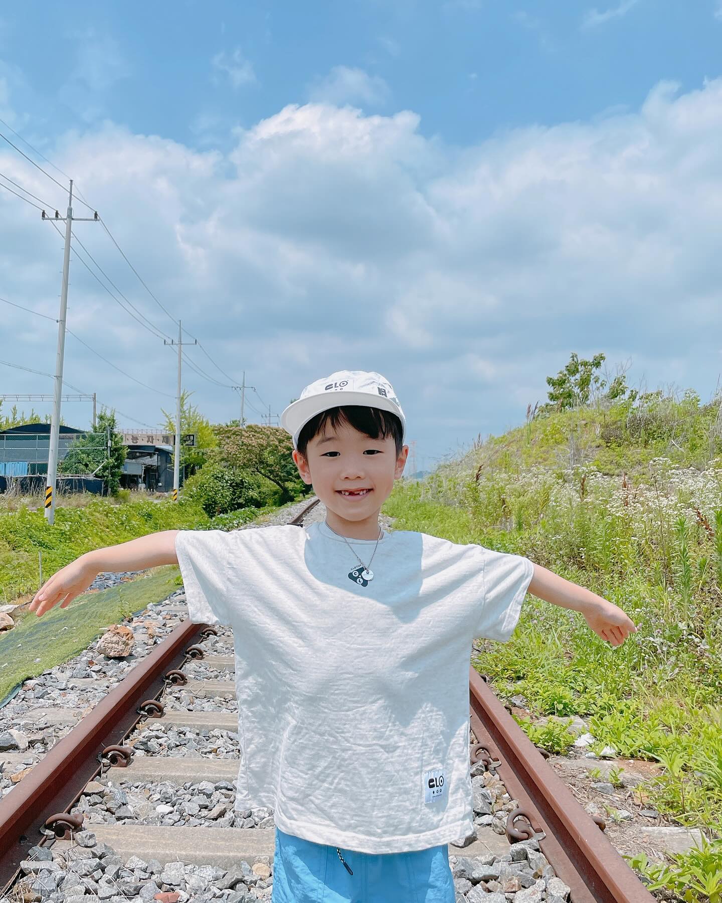 앞니없어도 빛나는 외모🫶🏻