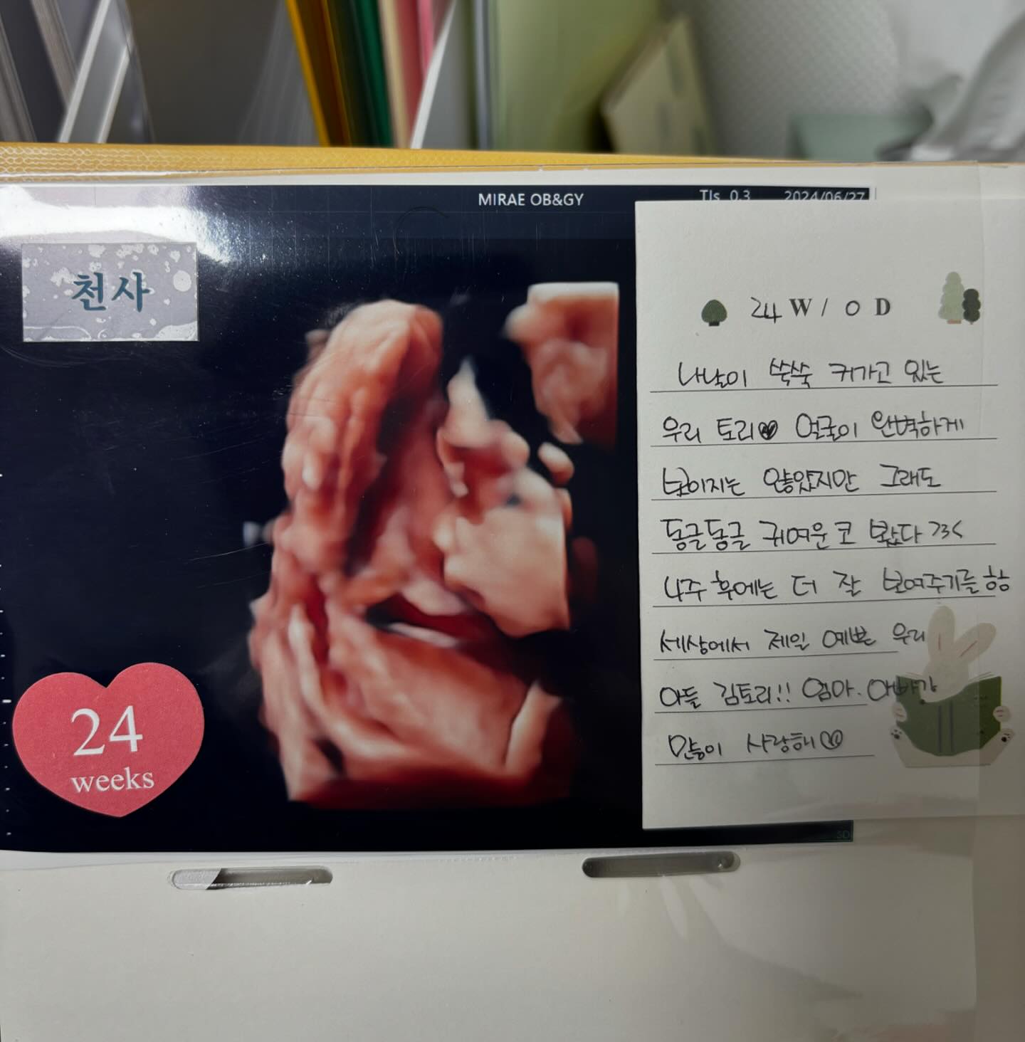 24주 임당 검사 하구 온 날💕
정상이구요 토리도 주수에 맞게 아주 잘 크고 있답니당 ㅎㅎ
저번보단 덜 부끄러웠는지 얼굴 살짝 더 보여준 우리 아들❤️
코가 동그란게 너무 귀엽구만 ㅎㅎㅎㅎㅎㄹㅎㄹㄹㅎㄹ 
4주 뒤에 언넝 더 큰 우리 토리 보러 가구싶규만

사랑한당 김토리❤️👶🏻