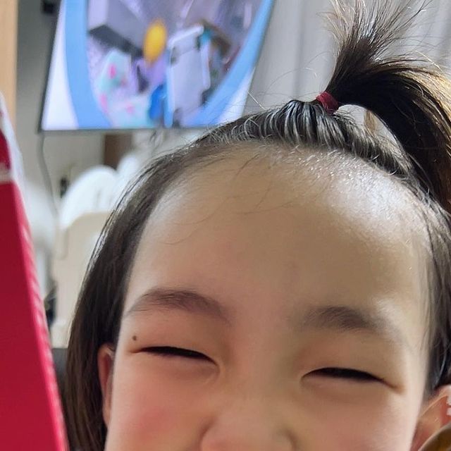 ᴊᴏ ᴊᴏᴏ ღ on Instagram: "업체로 부터 제공받은 제품입니다.

✅ 헤모키즈 매력
⠀
유소아 인체 적용 시험 완료
안정성(흡수율) 입증된 제품!!
유소아 대상 인체적용 시험을 통해
철분(페리틴) 수치가 증가가
확인되었다고 합니다 .
⠀
⠀
✔️특수코팅(마이크로캡슐화)
⠀
철분 사용으로 흡수가 잘되고
변비에 잘 걸리지 않는 제품
철분의 성질 자체가 배출하게 되면
딱딱하게 굳는 성질을 가지고 있는데
마이크로캡슐화 철분은 리포좀(인공막)
형태로 캡슐화하여
생체이용율과 안정성을 높여
철 자체의 좋지 않은 관능적 특성과
부작용을 개선해줌
⠀
⠀
✔️유럽 완제품 공정
⠀
유럽 액상전문 제조사 ErgoPharma (slovenia) 생산
유럽규격에 맞춰 완제품으로 직수입
닥터라인 헤모키즈의 포뮬러는
국내 뿐만 아니라
전세계 40여개국에 판매되며
제품의 우수성과
안정을 인정받았다고합니다.
⠀
맛있는 딸기맛 액상형 철분 보충용 제품
기존의 철 고유의 비릿한 맛이 아닌
맛있는 딸기맛으로 입맛 까다로운 아이들도
맛있게 섭취 가능하며
전용 스푼이 있는 액상형으로
섭취량 조절 용이하며
물에 타먹어야하는 가루 타입보다
아이에게 먹이기 쉬워용
하루 한번 2ml 계량스푼 섭취로 14mg 보충
⠀
⠀
🤩이런 아이들에게 추천드려봅니다🤩
⠀
✅철분이 부족하기
⠀⠀쉬운 유아 및 성장기 어린이
✅채식 위주의 식사를 하는 어린이
✅입맛이 까다로워
⠀⠀맛있는 철분섭취를 원하는 아이
✅액상 제형을 선호하는 어린이
✅쉽게 지치고 활력이 없는 어린이
✅급격히 신체 성장이 이루어지는 청소년
⠀
⠀
⠀
🚨철분부족하면
어떤 증상있을지 올려봅니다
⠀
✔️0-3세 잠투정 관련
⠀
철분 부족 및 결핍 유소아 대상으로
철분 보충제 섭취 결과
유소아 70% 이상이
수면의 질이 좋아진 사례가 있다고 합니다 .
생후 6개월 이후부터는
모체로부터 받은 철분이 소실되기 시작하여
철분 보충이 필요할 수 있음
⠀
⠀
✔️4-7세 ADHD 관련
⠀
정상 아이에 비해 ADHD 소견을 보인
아이들의 혈청 페리틴 농도가 낮음
혈청 페리틴이란
철분을 포함하고 있는
단백질을 이야기합니다.
⠀
⠀
✔️8-13세 학습능력 저하
⠀
혈액 내 철분이 부족한 아이는
주의력이 산만하고 장시간 집중하지 못함
철 결핍성 빈혈이 있는
유아의 지능 검사 결과가
정상 아이 대비 유의적으로
낮은 결과가 있음"