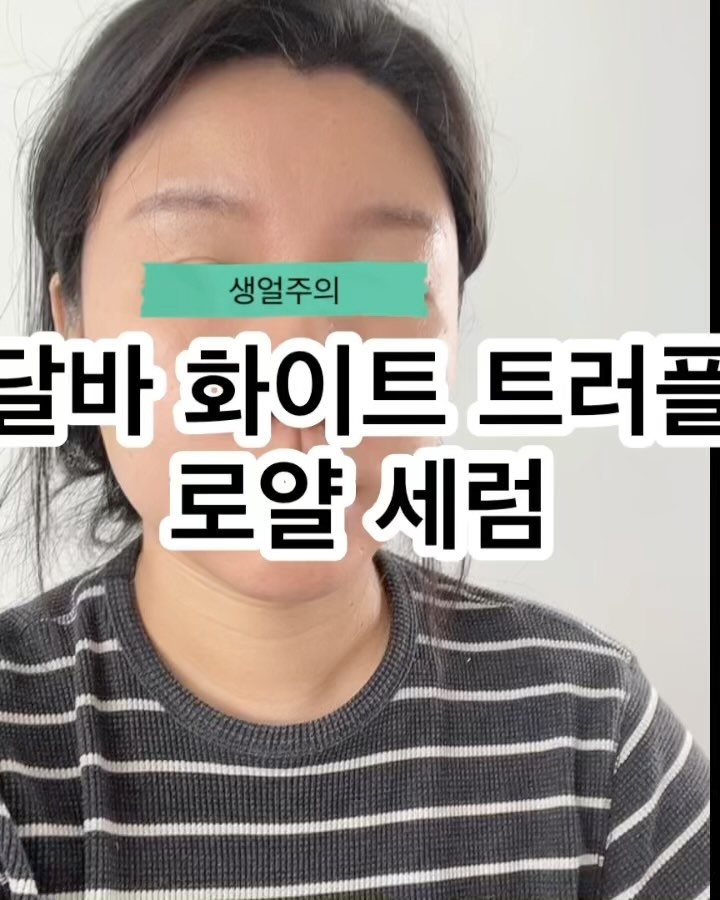 #제품협찬

가을만 되면 뜨기시작하는 내피부! 
영양가득한 무언가가 필요해서 받아본 로얄세럼

오랜만에 써보는 달바세럼이라 두근두근
성분이 업그레이드 되었다고 하니 
열심히 사용 할 예정이에요 :-) 

✔️새로 업그레드된 고농축 세럼 
색도 달라져서 뭔가 색달라보이는데요 ! 
달바 세럼 핵심성분이 업그레이드되서 더 촉촉한 느낌이에요 
요즘 유행하는 화이트트러플이 들어있대요!

✔️펩타이드 캡슐로 탄력 up!
주름개선과 보습에 효과가 있는 펩타이드가 함유되어 더욱 밀도있게 탄력에 도움을 준대요

✔️달바만의 시그니처 향
이탈리안 조향사와 콜라보해서 뿌릴때마다 편안해지는 향
달바만의 향이 나는 세럼! 
독하지 않고 은은해서 많이 뿌려도 좋아요 :-)

dalba_piedmont 
#달바로얄세럼 #세럼추천 #미스트추천
 #세럼미스트추천 #미스트세럼추천
#달바세럼시즌5 #항산화세럼 
#비건세럼 #로얄인센티브세럼 #화이트트러플 
#비건콜라겐세럼 #달바미스트세럼 #달바세럼