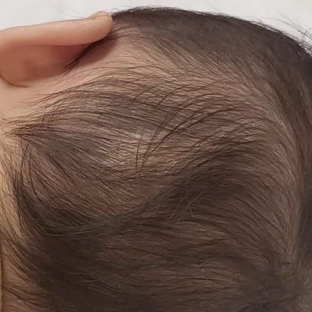 정원👶❤️ on Instagram: "#광고 아이누오에서 정원이에게 두상 베개를 선물로 보내주셨어요!🎁 아이누오는 단두증 및 사두증 진단을 받은 둘째를 위해 아빠가 직접 제작하신 아이베개입니