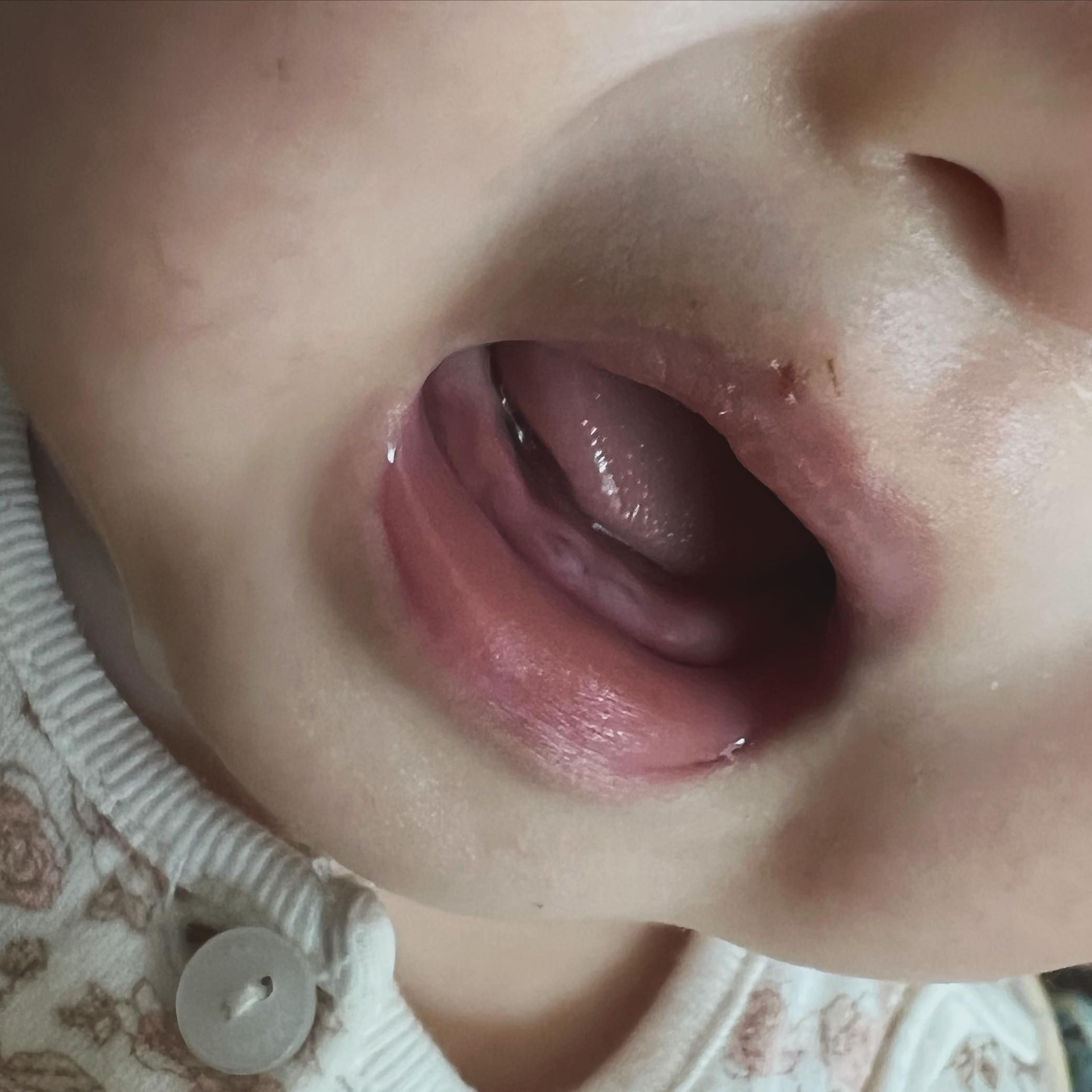 D+230 
드디어 앞니가 자랐어요 🤭
또래에 비해 늦게 자라서 걱정 많이 했는데
요렇게 쌀알을 보니 감개가 무량 🥰

칫솔치약은 뭐가 좋은가요?.?
마구마구 츄천 부탁드려요 🥰