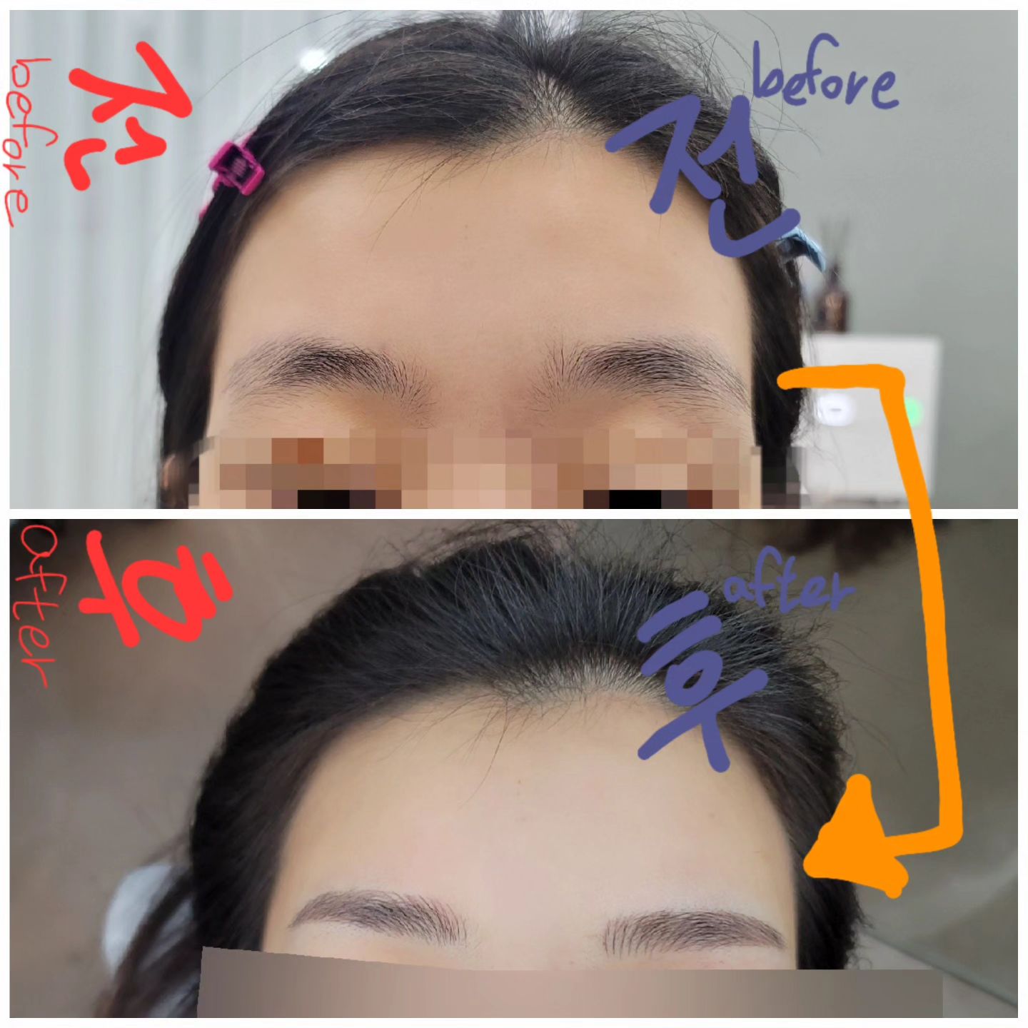 친구에게 선물해준 눈썹관리!
.
친구가 눈썹관리 너무 받아보고싶다해서 제가 선물했어요 ㅎㅎ
.
인상이 깨끗해졌어요. 이미지가 깔끔해졌어요.
분위기가 달라졌어요. 정돈된 느낌이 들어요. 관리한 티가 나요.
.
눈썹 속눈썹으로 유명한 공덕 이츠더뷰티로 갔는데요 ㅎㅎ
경력많은 원장님의 꼼꼼한 체크와 디자인 도안으로 정말 멋진 눈썹이 탄생했어요.
.
이미지 변신에 아주 확실한 효과를 주는 눈썹!에 변화가 필요하다면 이츠더뷰티 추천합니다 ㅎㅎ
.
.
.
.
#이츠더뷰티 #공덕속눈썹 #마포속눈썹 #공덕눈썹 #마포눈썹 #눈썹 #리터치 #속눈썹펌 #눈썹문신 #눈썹정리 #눈썹그리기 #눈썹추천 itsthebeauty4218