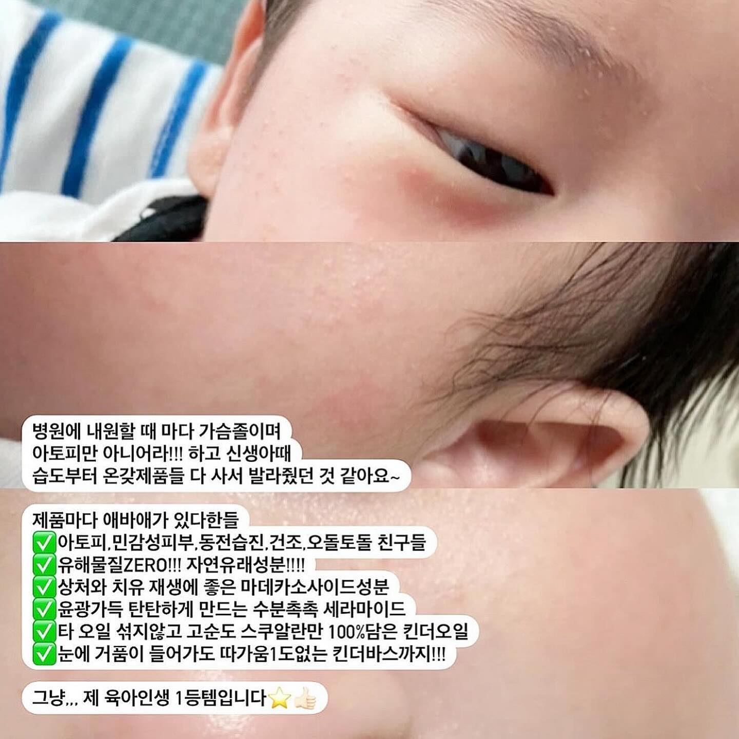 아토피직전, 킨더로 고민해결✊🏻 제이야기뿐만 아니라 이제는 우리 아듀x킨더팸들 많은분들이 스토어에 작성해주는 진솔한 후기만 봐도
알 수 있는데요....!🩷
⠀ 
📍공구 오늘 마지막날! 마감안내해요📍
📍다음공구텀은 11월입니다

생후 2개월쯤부터 시작된 건조함. 초보엄마는 어떻게해야하나
병원에 내원할 때 마다 가슴졸이며
아토피만 아니어라!!! 하고 신생아때
습도맞추려고 고생, 온갖제품들 다 사서 그당시
돈ㅈㄹ도 진짜 많이했어요ㅠ 얼굴에 바르는것인 만큼 당근?노노
테스트할 겸 무조건 새 제품 사줘야쥬😭

제품마다 애바애가 있다한들
✅아토피,민감성피부,동전습진,건조,오돌토돌 친구들
✅유해물질ZERO!!! 자연유래성분!!!!
✅상처와 치유 재생에 좋은 마데카소사이드성분
✅윤광가득 탄탄하게 만드는 수분촉촉 세라마이드
✅타 오일 섞지않고 고순도 스쿠알란만 100%담은 킨더오일
✅눈에 거품이 들어가도 따가움1도없는 킨더바스까지!!!

그냥,,, 제 육아인생 1등템입니다⭐️👍🏻
⠀ 
🧴🧴🧴
영유아 스킨케어는 사실 일반화장품군에서도
가장 좋은성분❗️즉, 순하고 트러블유발물질 등
최대한 피하고 피해만든다는 것 잘 아실텐데요~!
그 모든걸 완벽하게 만들어 제조부터 마감까지 모두
100%밀봉 이중캡으로 발송나가는게바로
#킨더브리제
⠀ 
21차공동구매 ! 구매이벤트 자동참여‼️
내일오전 10시 당일출고 시작해요‼️
⠀
