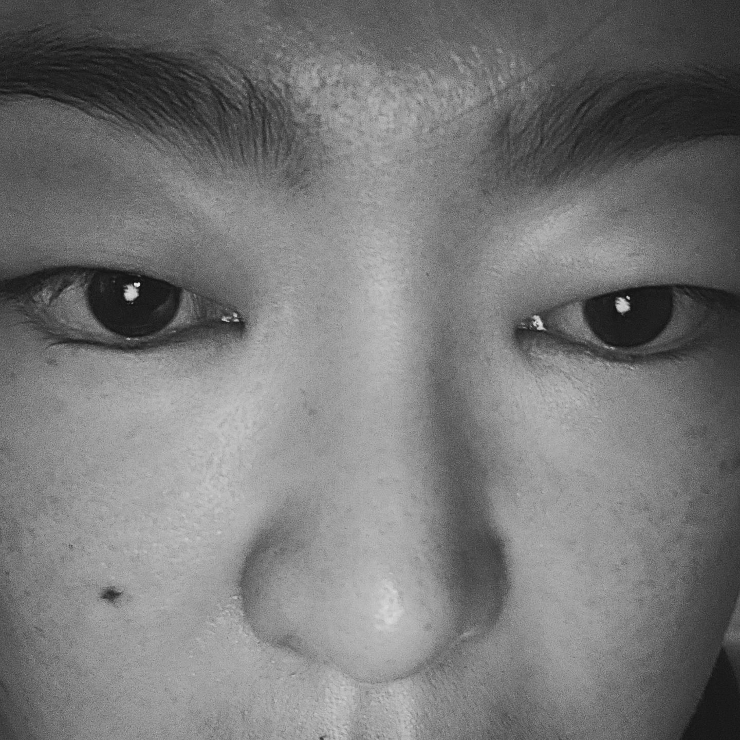 역류성 식도염 약먹고 잤을뿐인데..
깜놀.
저녁에 먹으라며~! 
작은알약 3개의 파워냐?
잠이 오는 약이라더니..
계속 눕게만듬.이것이 문제.
그냥 나도 편히 자고싶지만 아드님이 ..
대성통곡을 하고  자도  이렇게 부은적은 없다.
조카님이 보더니 심한데?
나가놀고싶던 아드님 애미가 상태가 이지경이라 
눈치보더라. 그러고는  못눕게할라고 이불 싹 치우고..
일단 오늘 저녁약 먹었는데. 
내일아침에도 또 부으면?  부작용이 맞는걸로.
