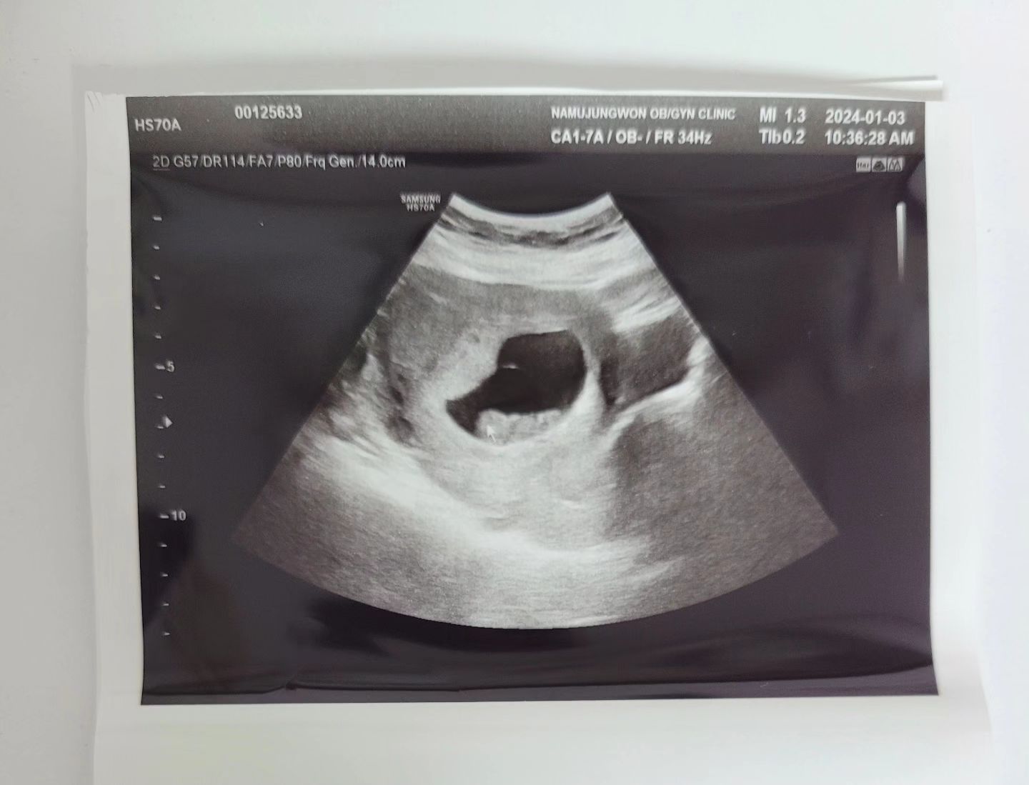 오늘로 8주5일 된 행복이♡
팔, 다리도 나오고 있고 심장도 힘차게 뛰는 우리 둘째!
청룡의 해에 만날 생각하니까 설렌다!

양주시 보건소에서 임산부 선물도 받고,
임테기로 처음 행복이 존재를 알게 된지 벌써 한달이 다 되어가네♡

#청룡의해탄생 #청룡맘 #임신8주5일 #둘째맘