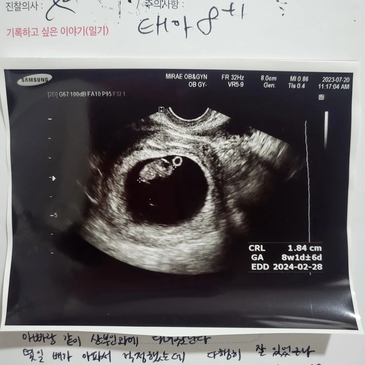 푸른이동생 하늘이가 와줬어요~~
태명은 사랑이! 8주기록 💛
건강하게 쑥쑥 자라자💛

#임신초기 #둘째맘 #딸원츄