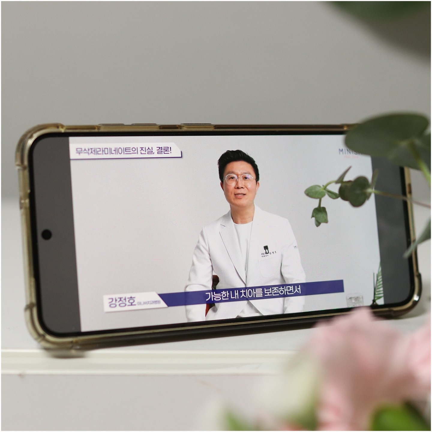 #광고

환하게 웃는 모습이 예쁜 사람이 정말 부러워서 라미네이트에 대해서 많이 검색해봤는데요~ 연예인들이 많이 한다는 #무삭제라미네이트 가 있다는걸 알게되었어요..

근데, 무삭제 라미네이트에 속지마세요!!!???
치과의사선생님 알려주시는 #무삭제라이네이트 에 대한 진실을 보고는 정말 깜짝 놀랐어요.

무삭제 라미네이트 특별한 기술이 있어야만 가능한게 아니라
이를 안 깍고 붙이기만 하면 되기 때문에 어떤 치과의사나 치료할 수 있는건데, 무삭제라는 말로 마케팅 수단으로 사용되고 있다고 하더라구요!!!

무삭제라미네이트는 특정한 치아에 한정된 방법으로
왜소치(작은 치아), 벌어진 치아, 옥니(이가 안으로 들어가 있는 케이스) 등의 케이스를 제외하고는 이를 안 다듬고 붙이기만 하면 치아가 커보이고 튀어나와서 부담스럽거나 미적으로도 예쁘지 않을 수 있어요.

치아를 오래사용하기 위해서는 삭제가 필요한 경우도 있지만 삭제가 전혀 필요하지 않는 경우도 있다고 하니 불필요한 삭제 없이 건강하게 예뻐지게 해주는 치료가 필요하겠죠?

손상된 치아를 원래대로 복구하는 치아복구 솔루션인 미니쉬 는 건전한 치아를 희생시키지 않고 불필요한 삭제 없이 치료하는게 핵심인데요~!
 
치료전 치과 전문가와의 꼼꼼한 상담후 손상된 치아도 치료하고 건강하게 예뻐지세요~!

😀미니쉬치과병원
✔ 서울 강남구 언주로 728
✔ 1899-2854
✔ minish.co.kr

#연예인라미네이트 #치아성형 #라미네이트후기 #라미네이트